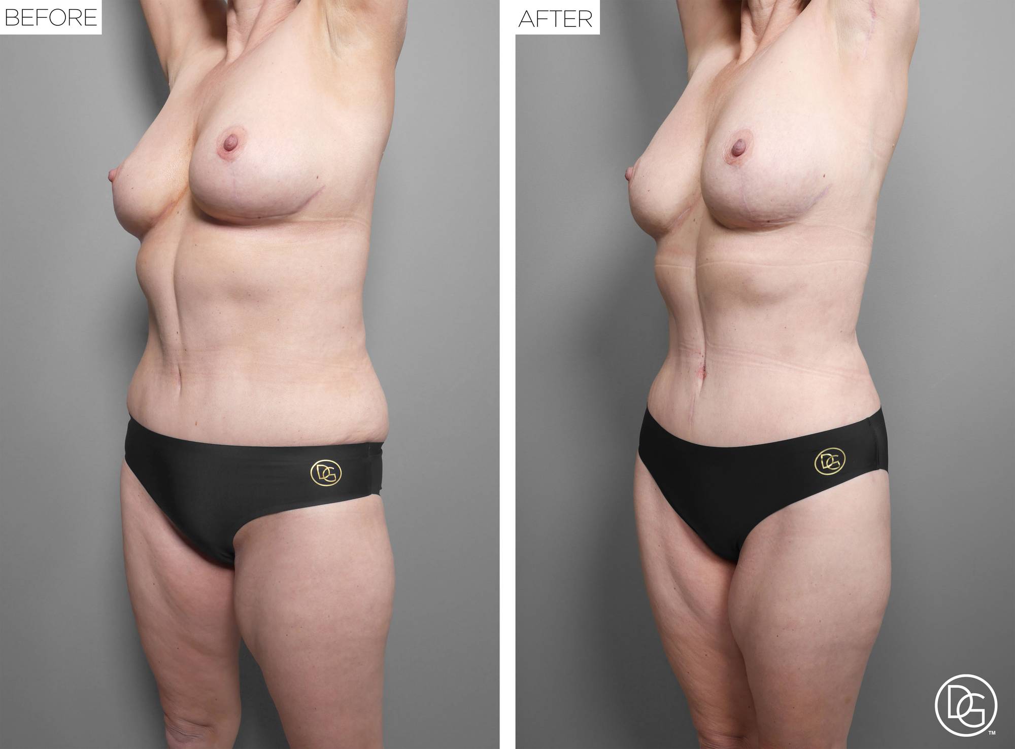 Before & After Image