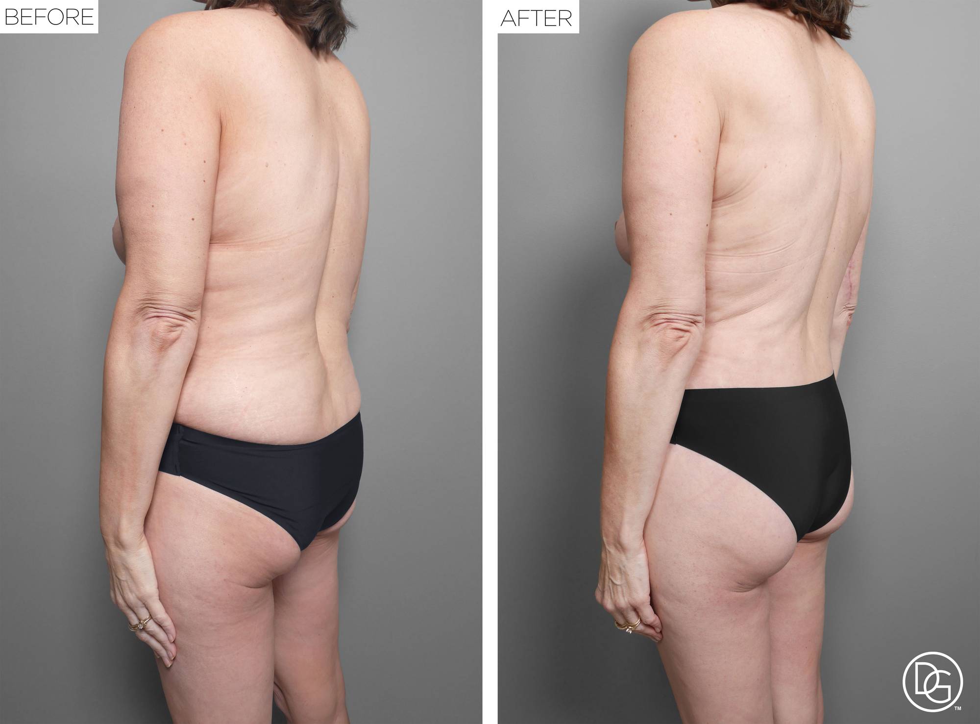 Before & After Image