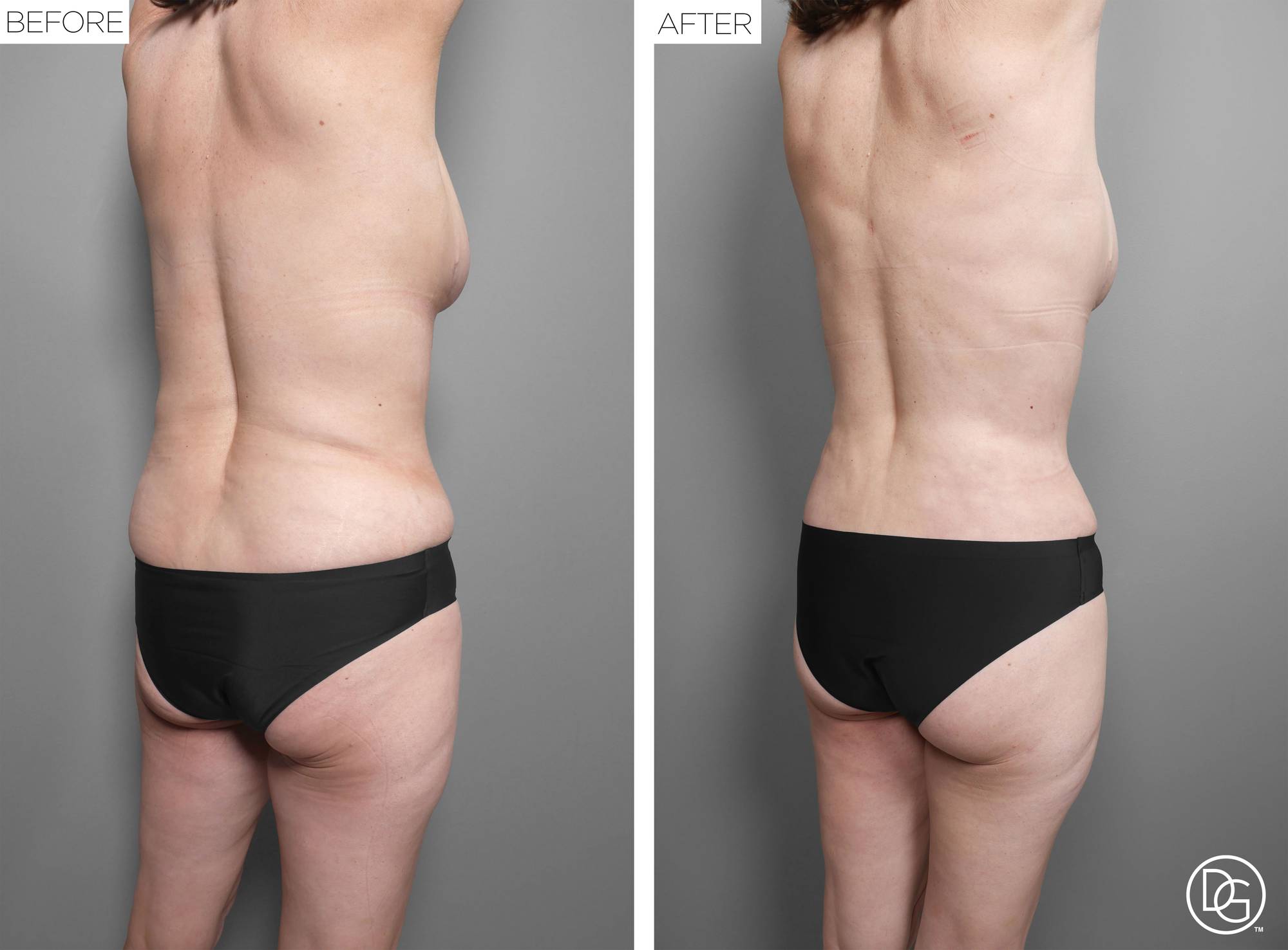 Before & After Image