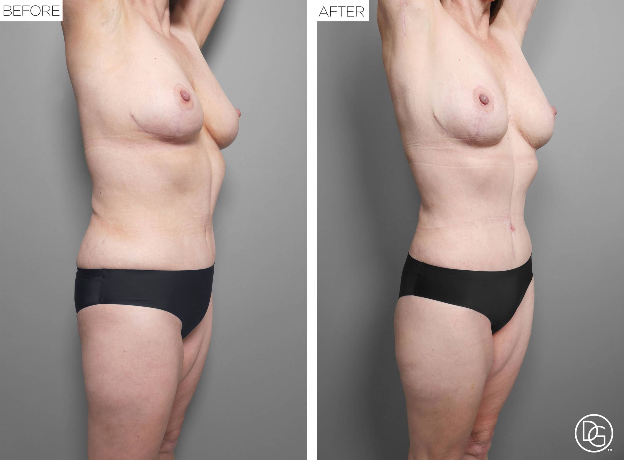 Before & After Image