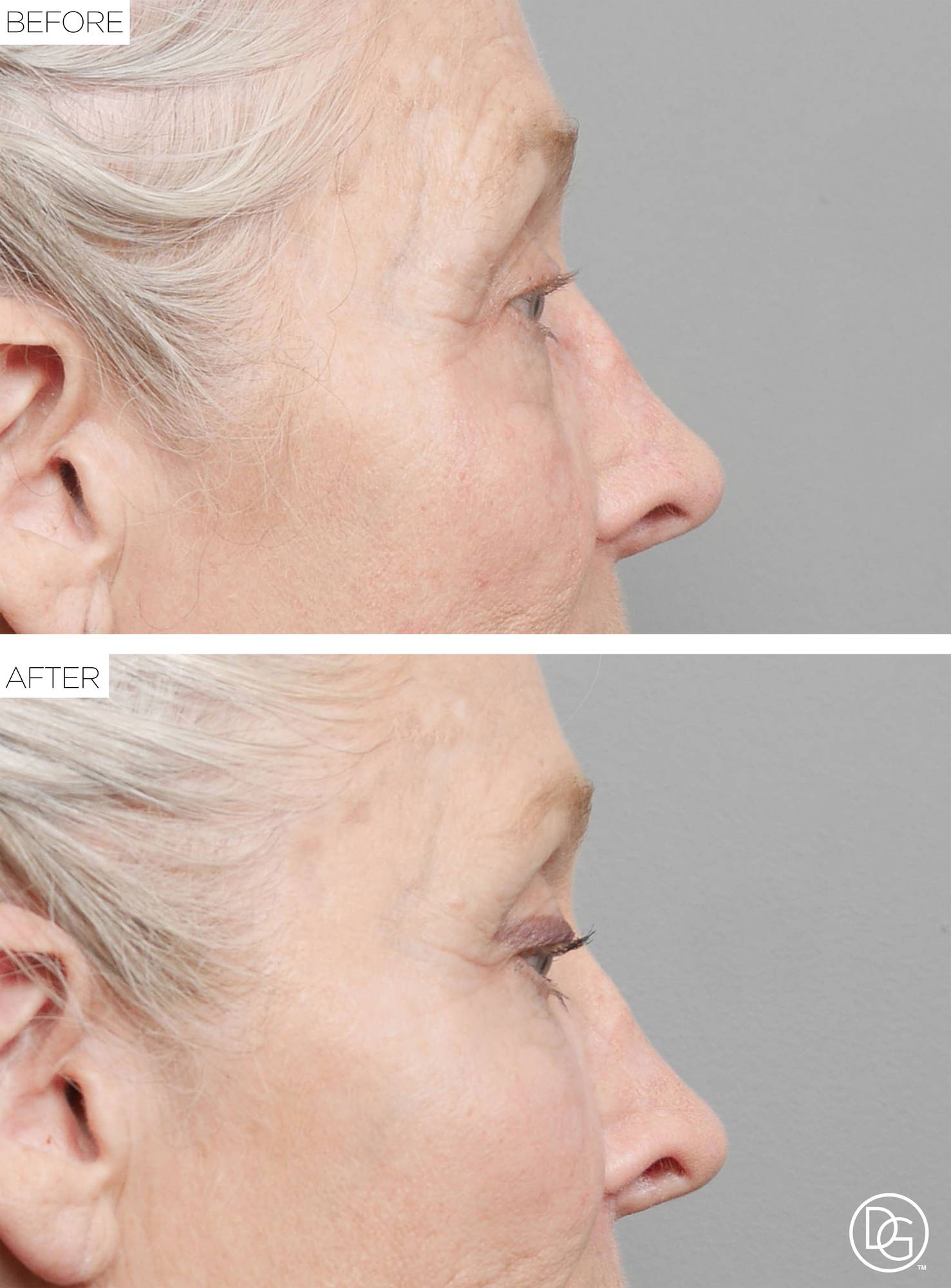Before & After Image