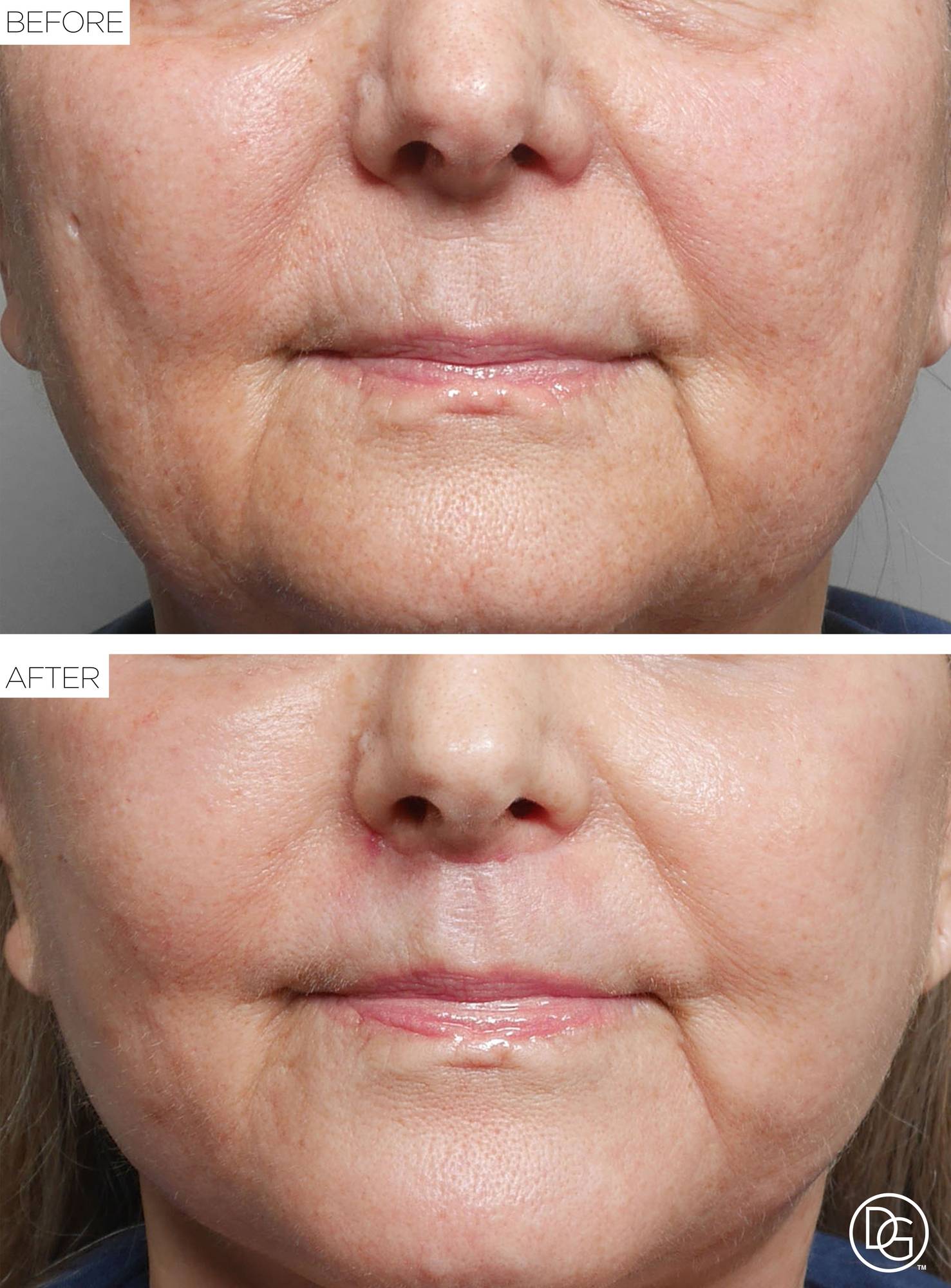 Before & After Image