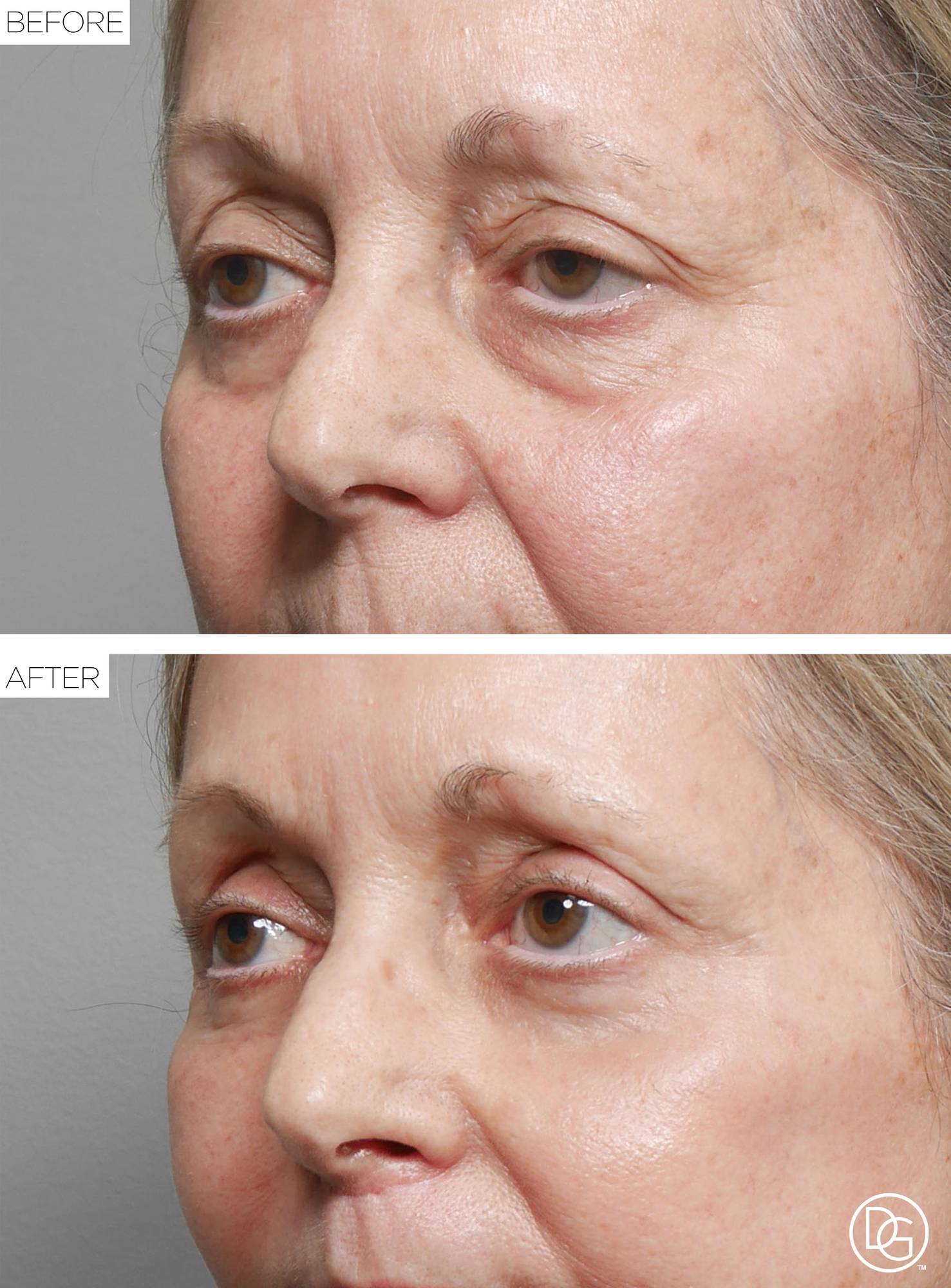Before & After Image