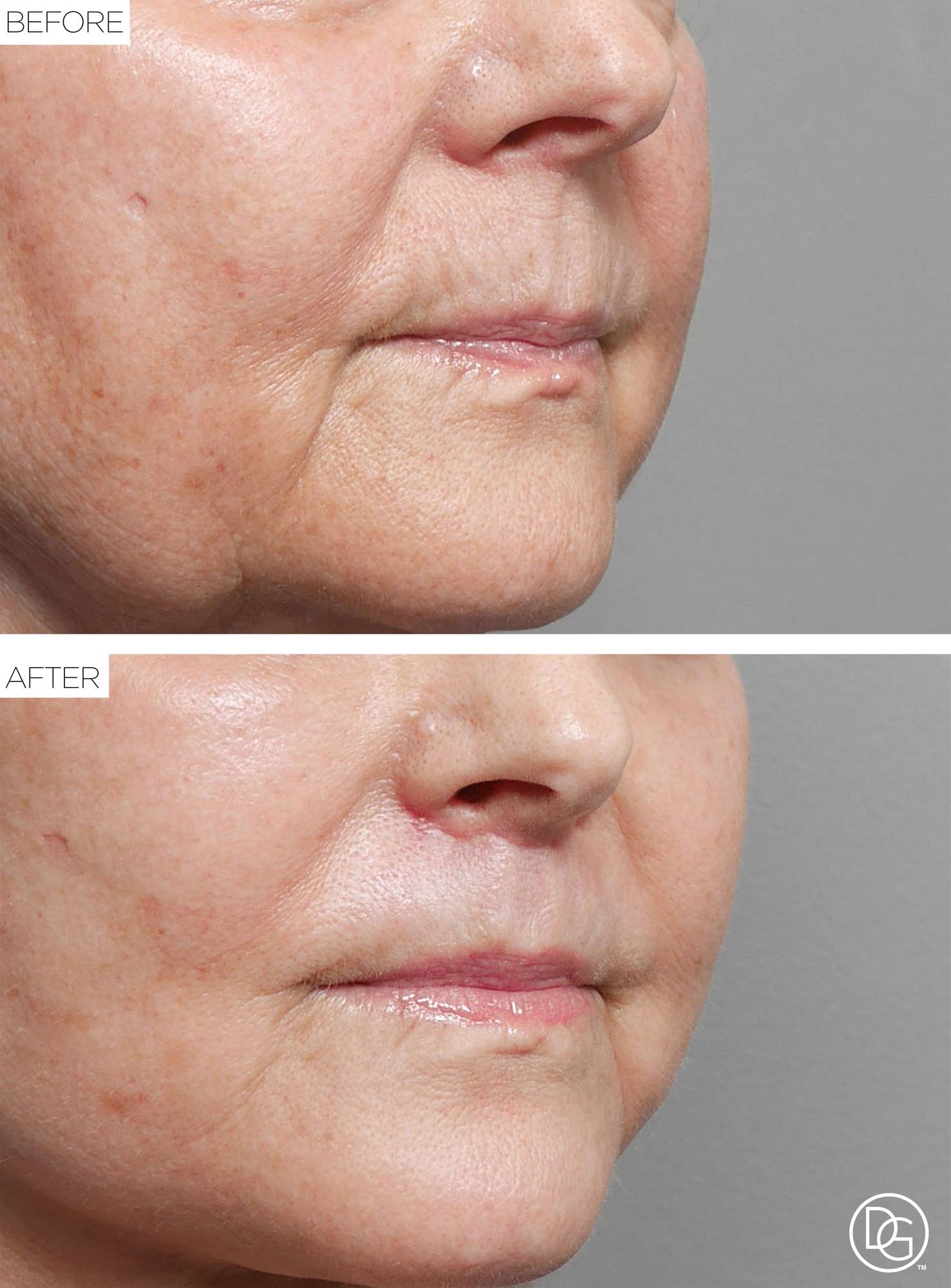 Before & After Image