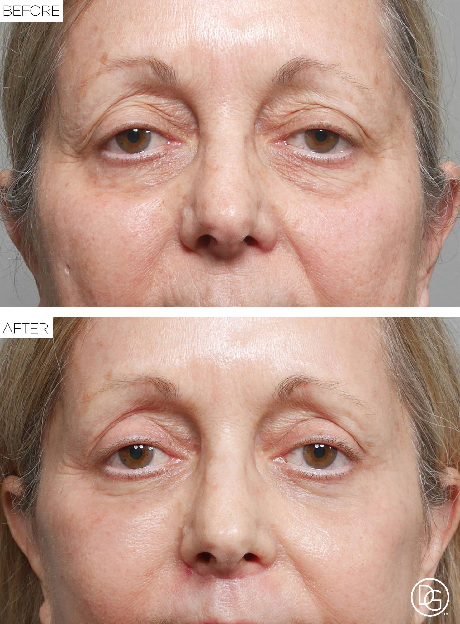 Before & After Image