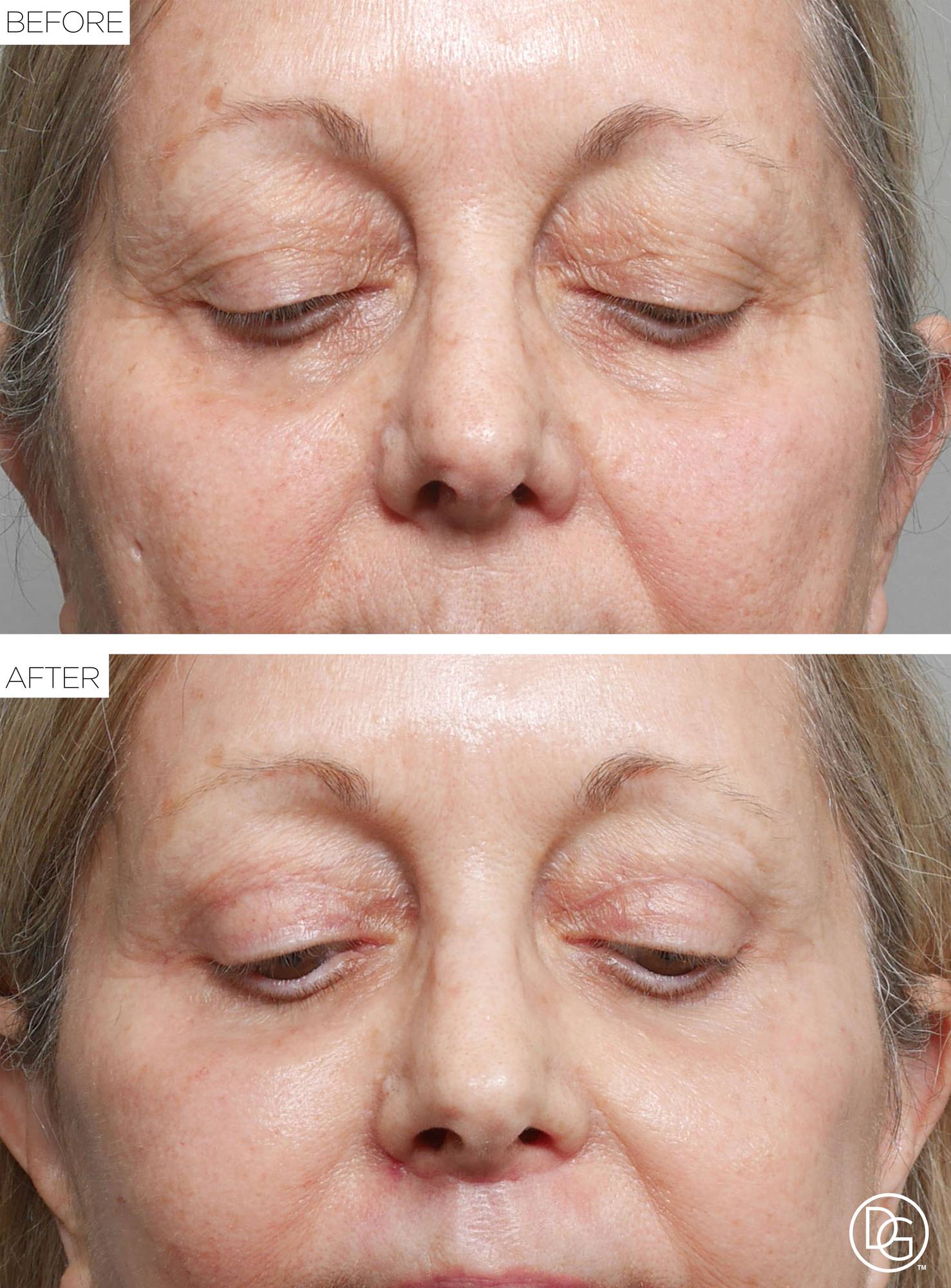 Before & After Image