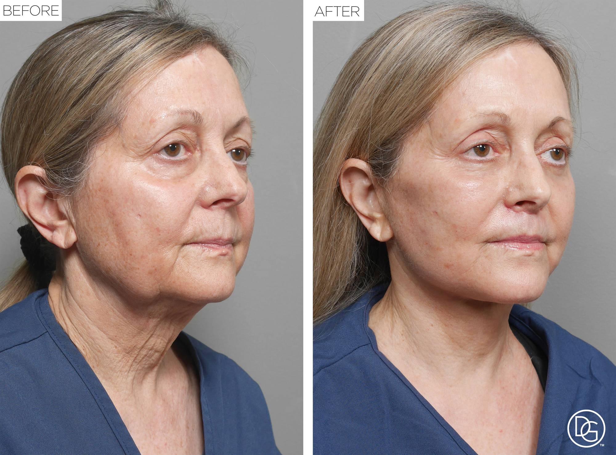Before & After Image