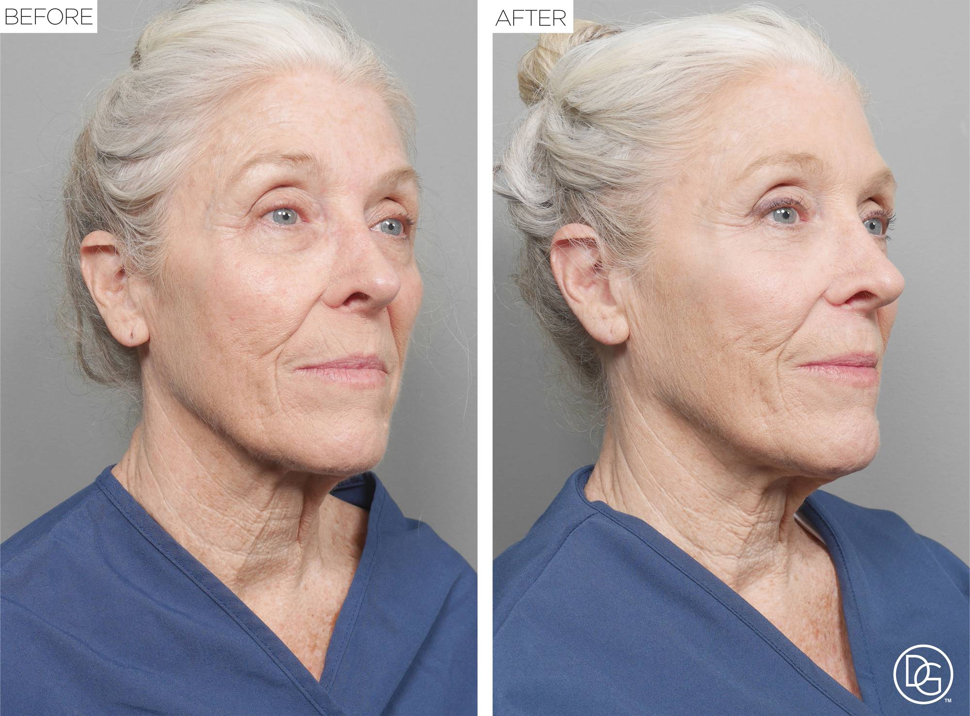 Before & After Image