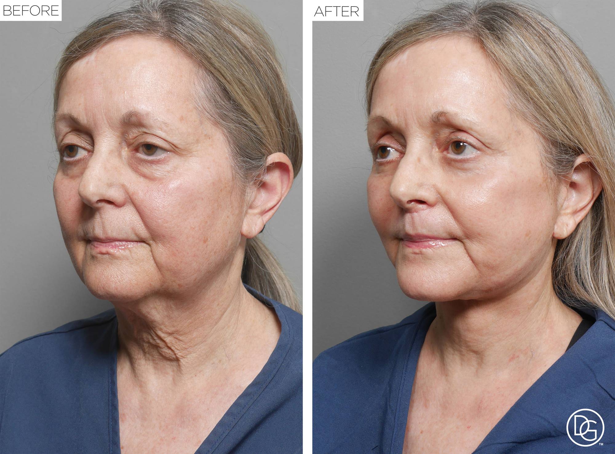 Before & After Image