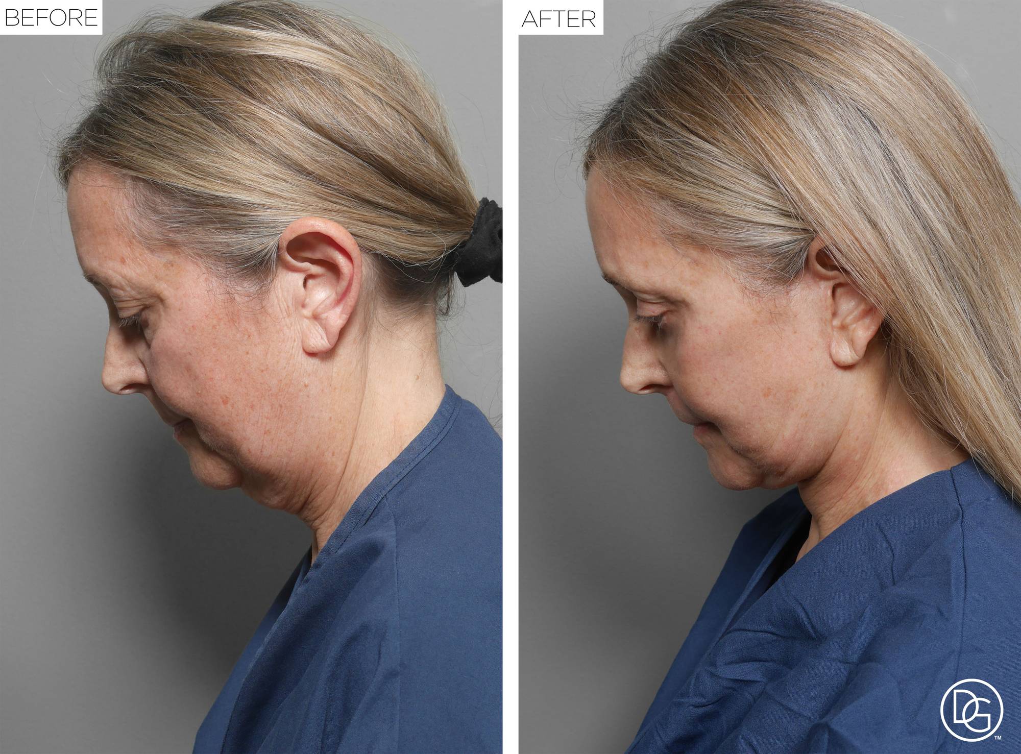 Before & After Image