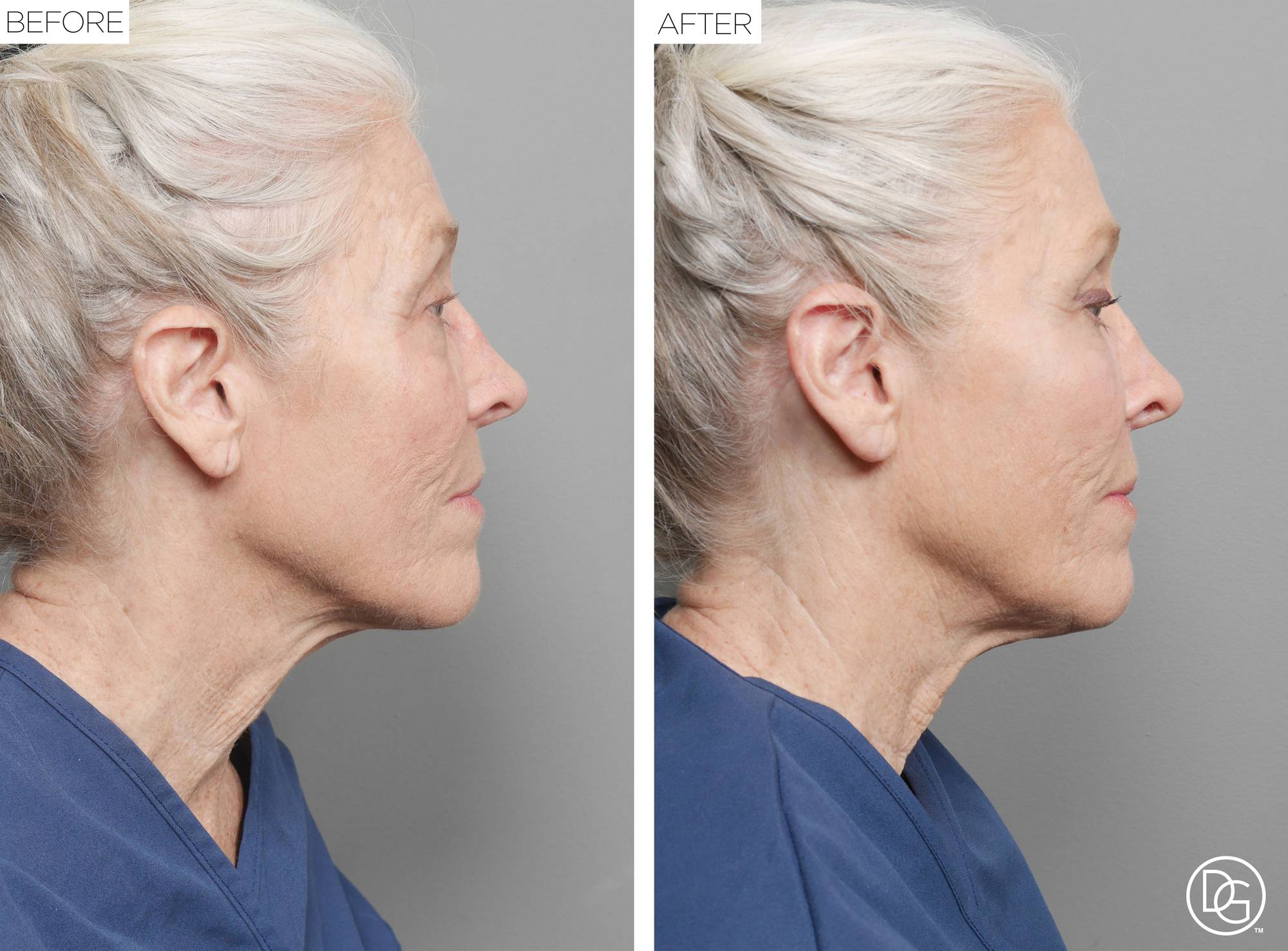 Before & After Image