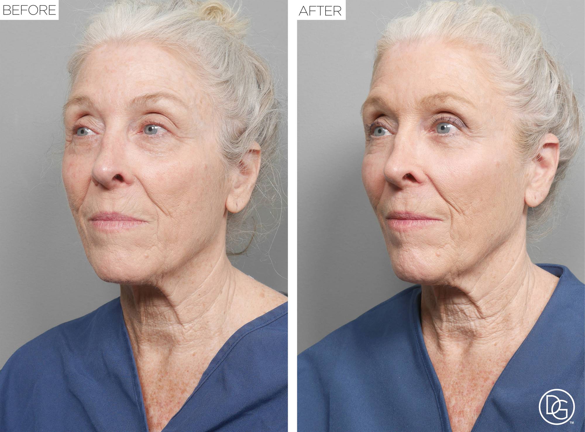 Before & After Image