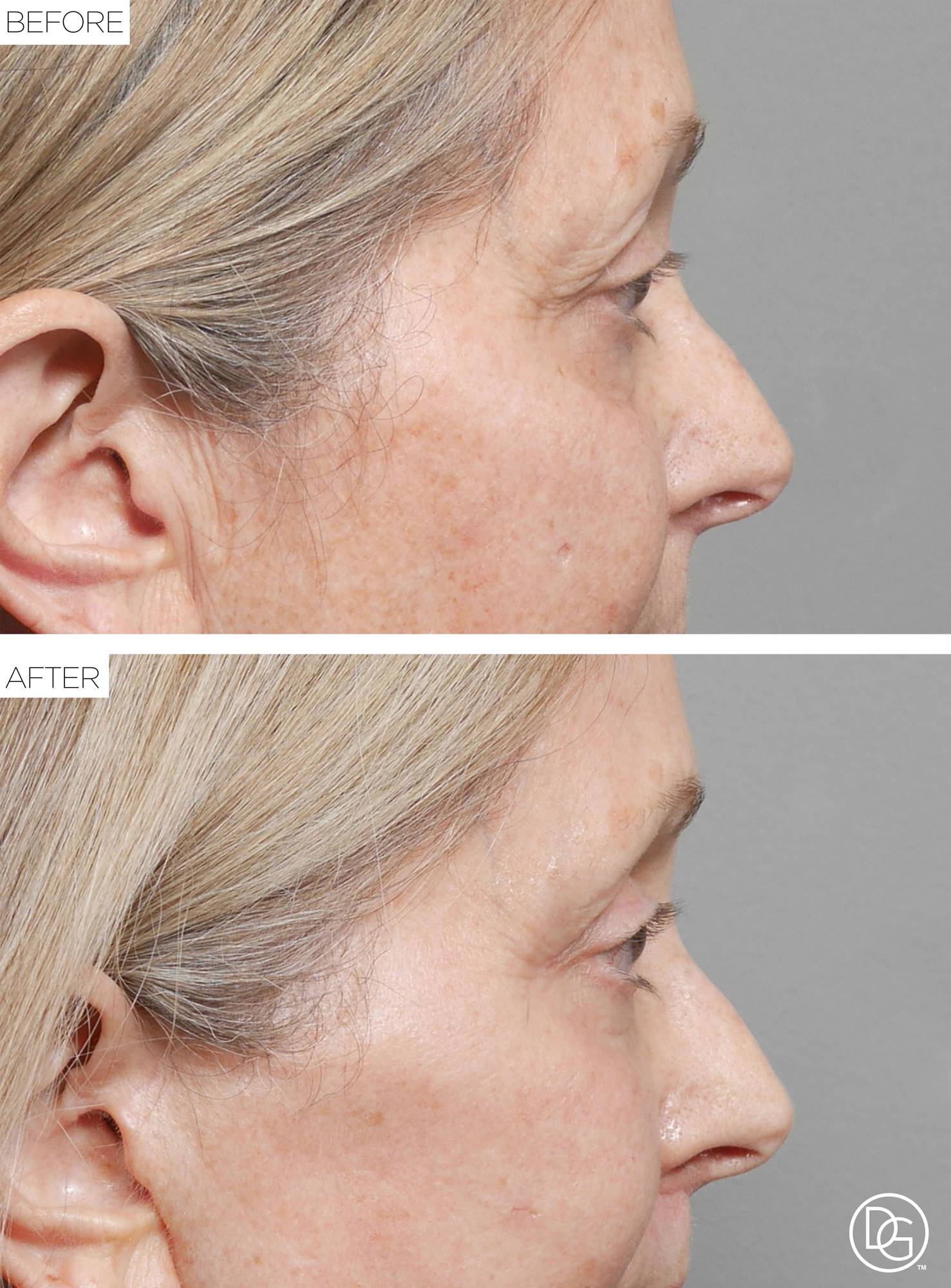 Before & After Image