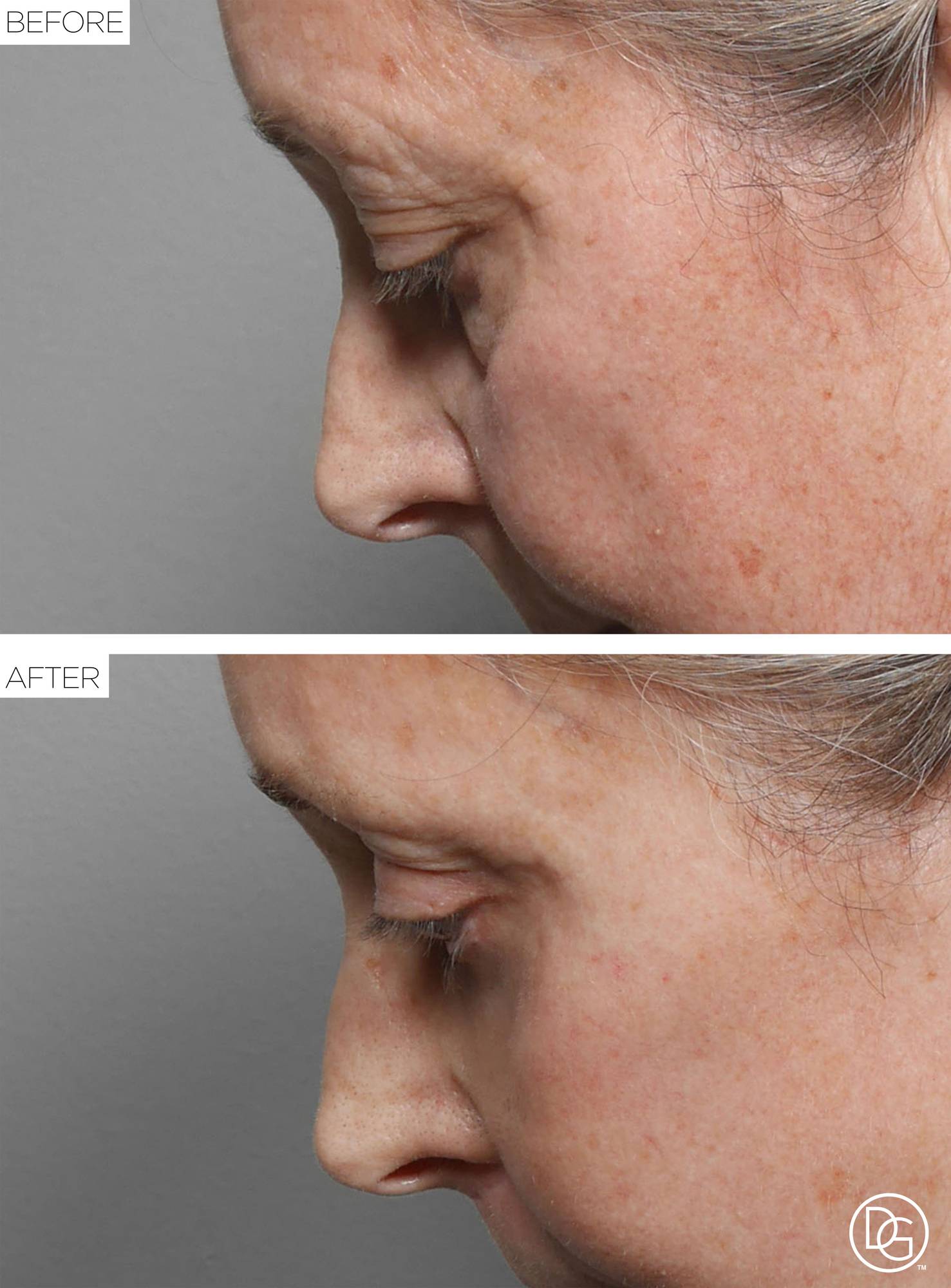 Before & After Image
