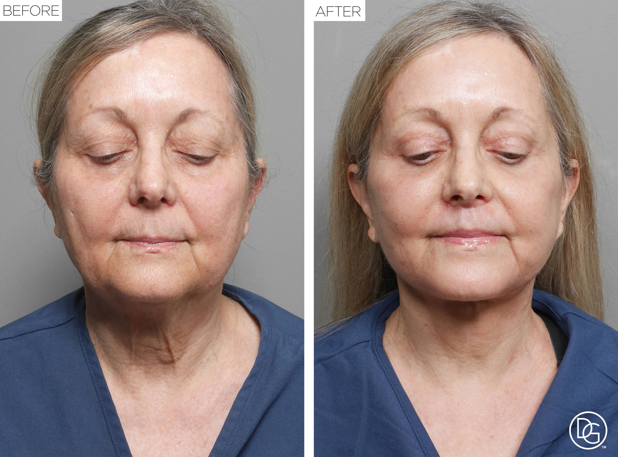 Before & After Image