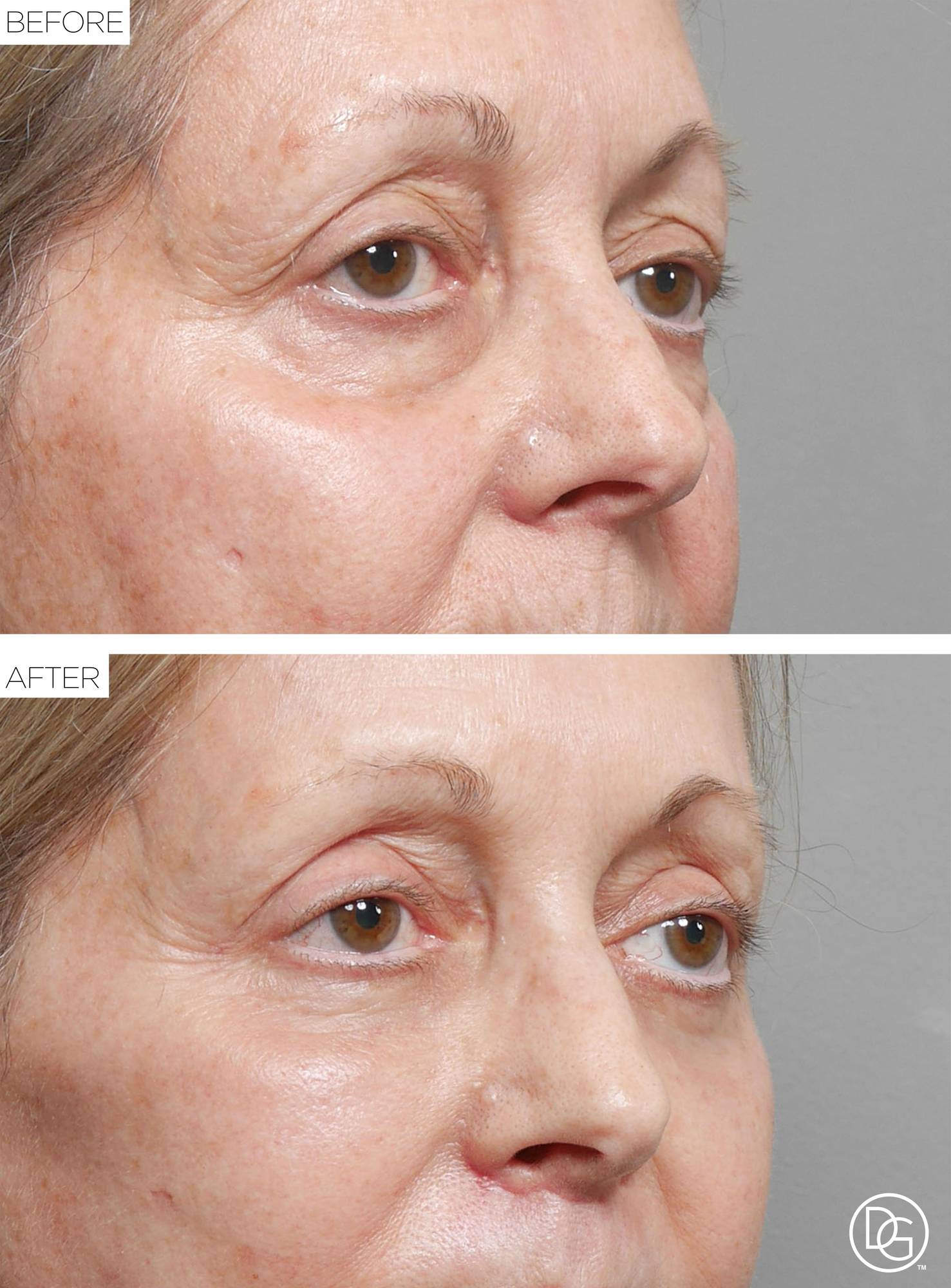 Before & After Image