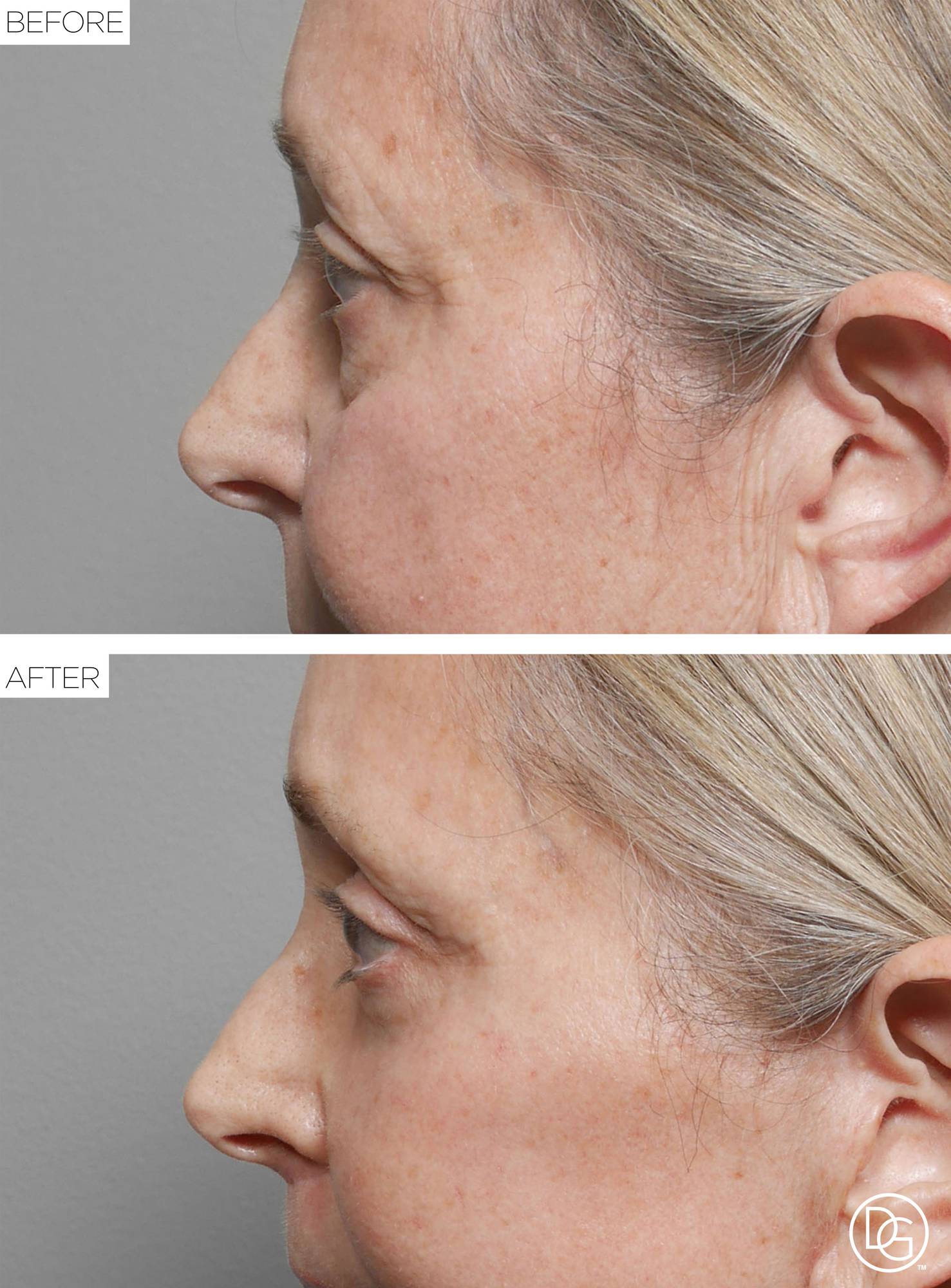 Before & After Image