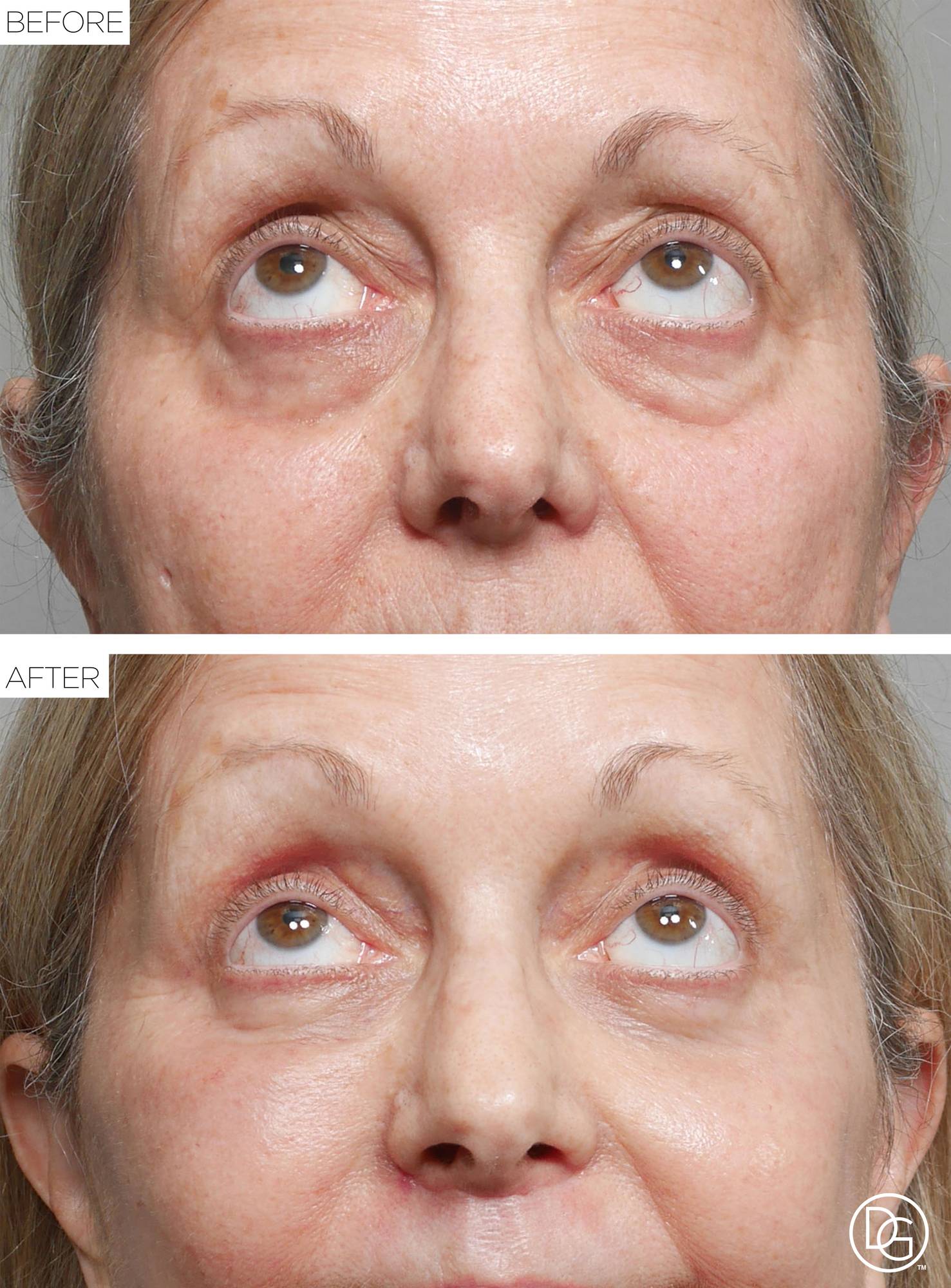 Before & After Image