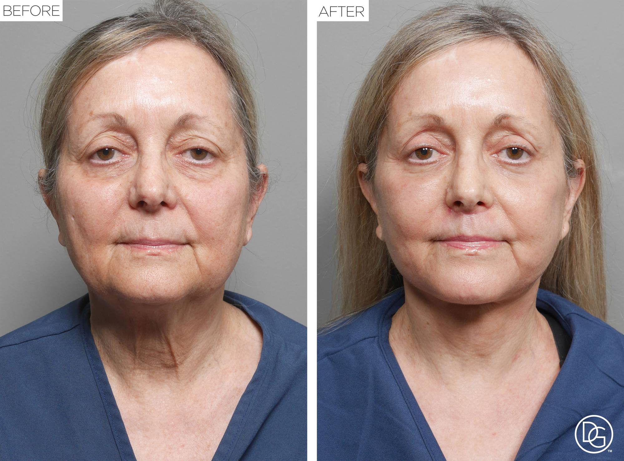 Before & After Image