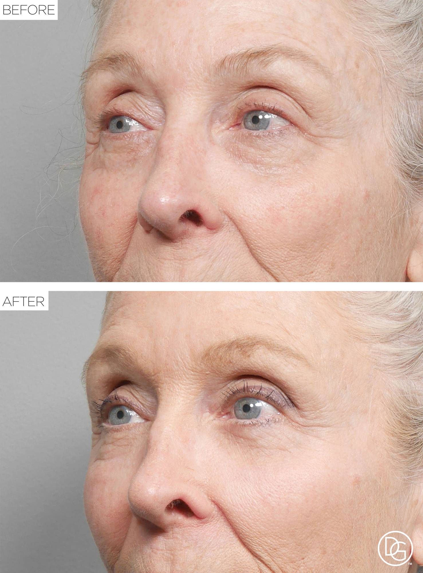 Before & After Image
