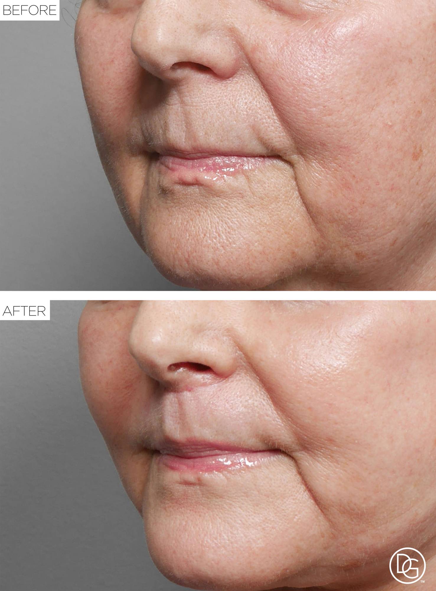 Before & After Image
