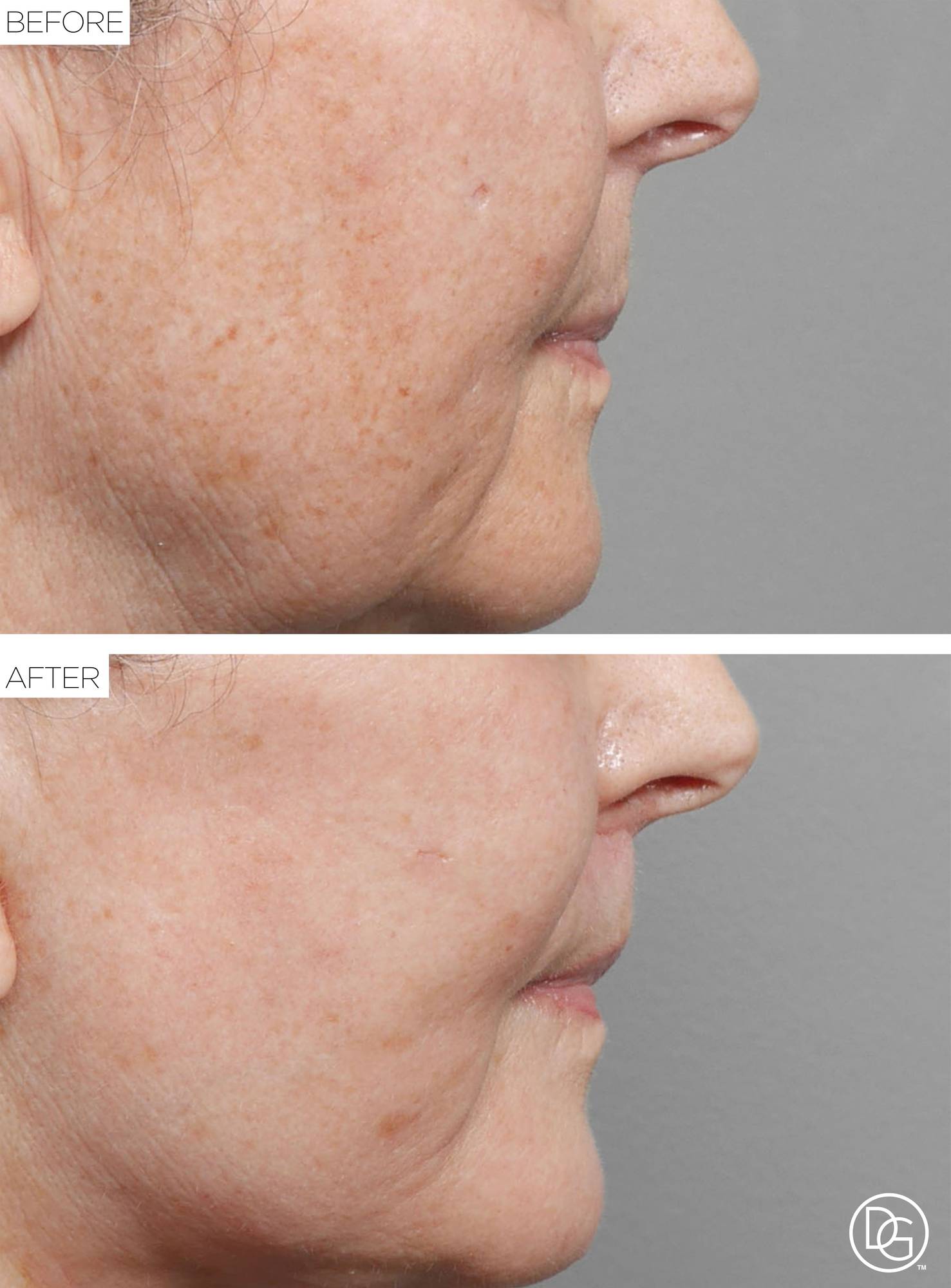 Before & After Image