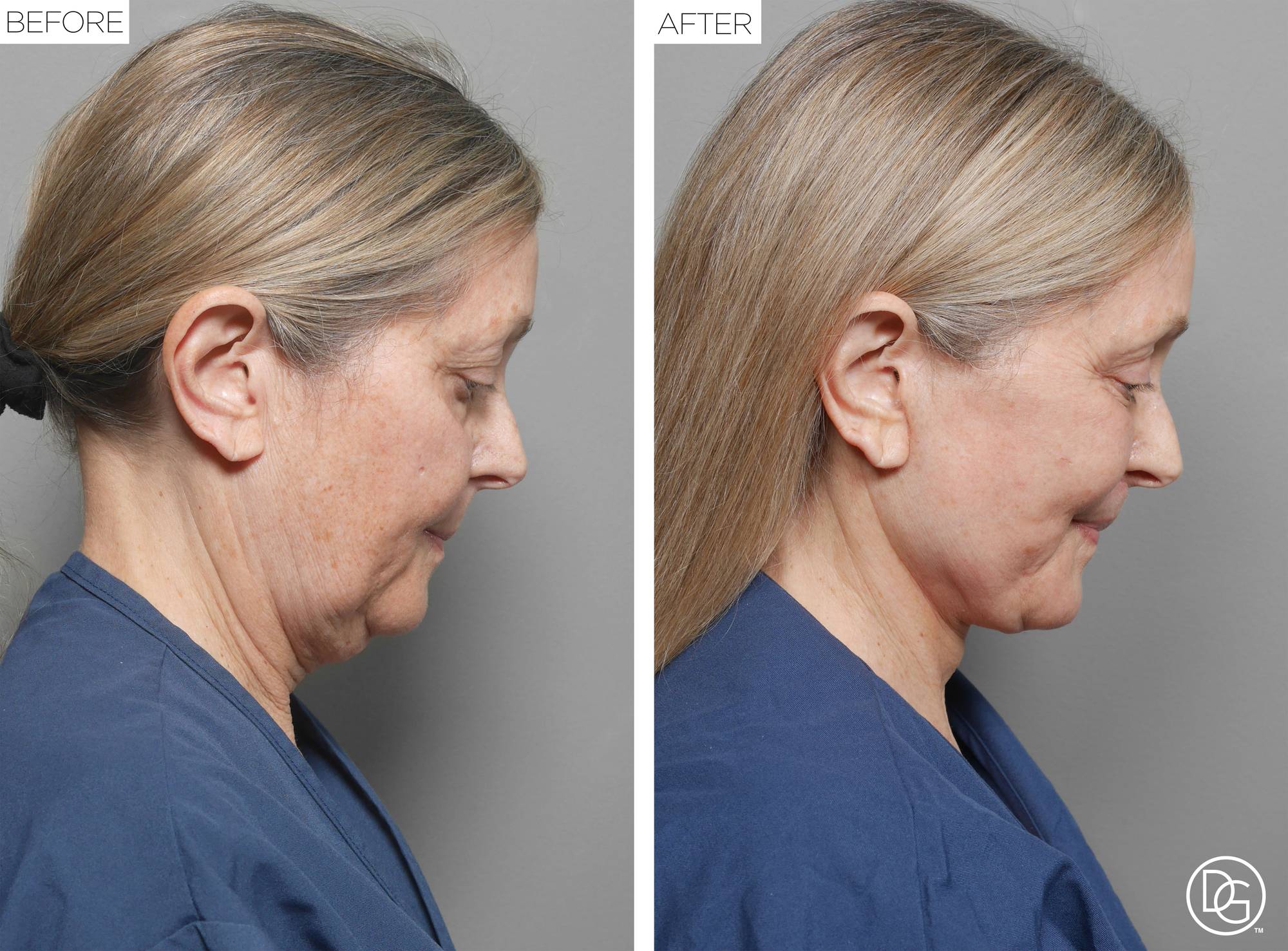 Before & After Image