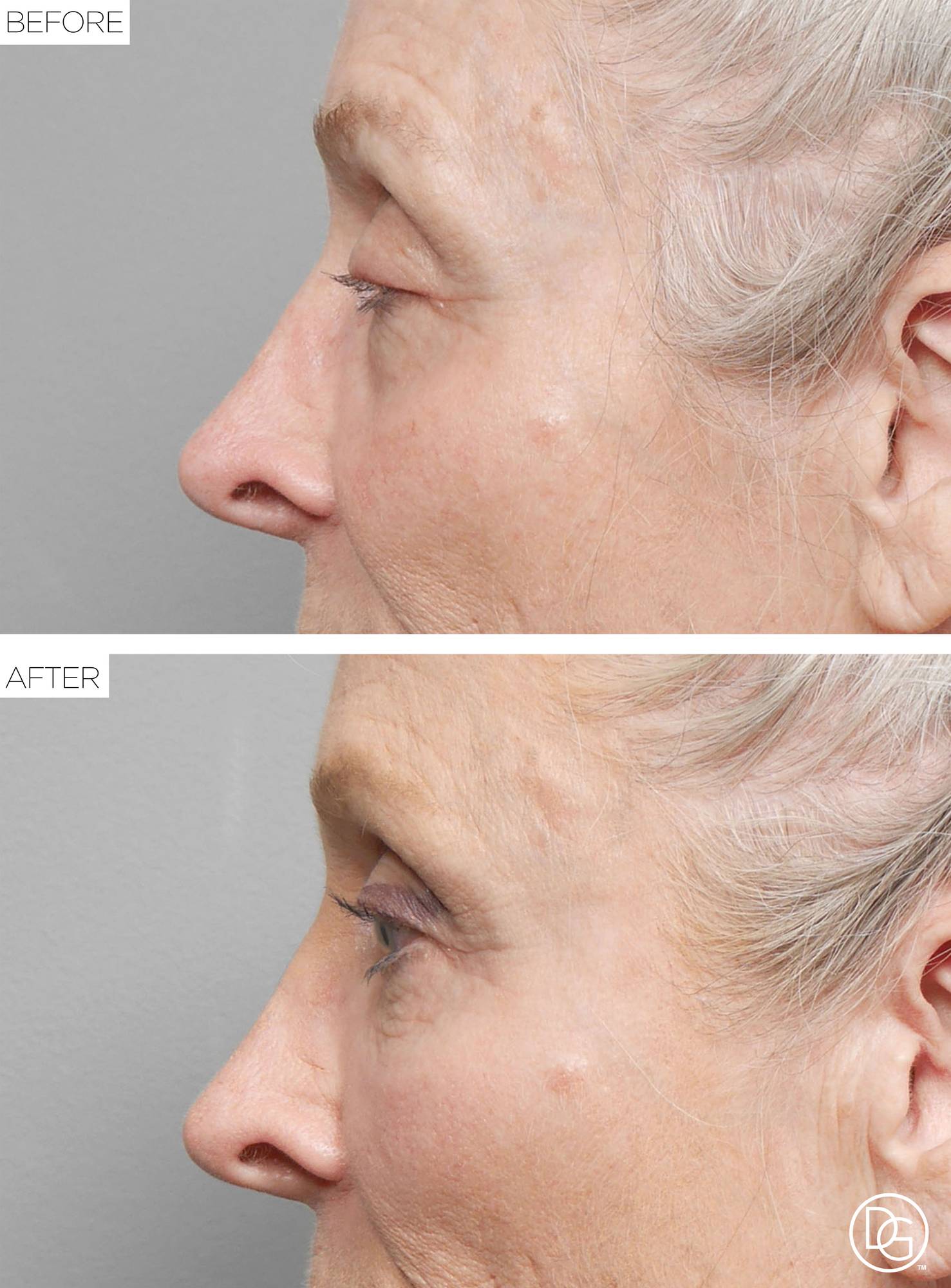 Before & After Image