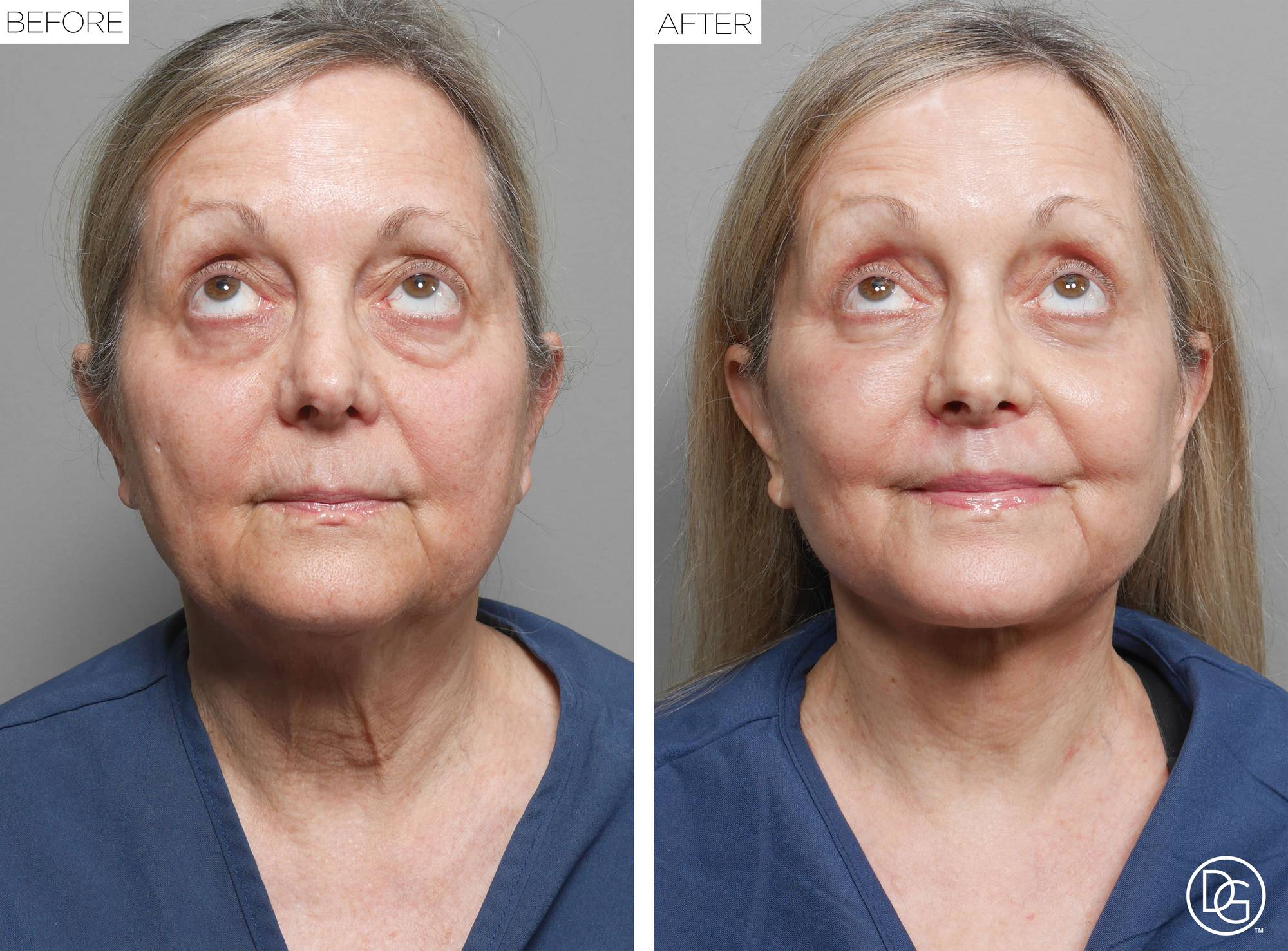 Before & After Image