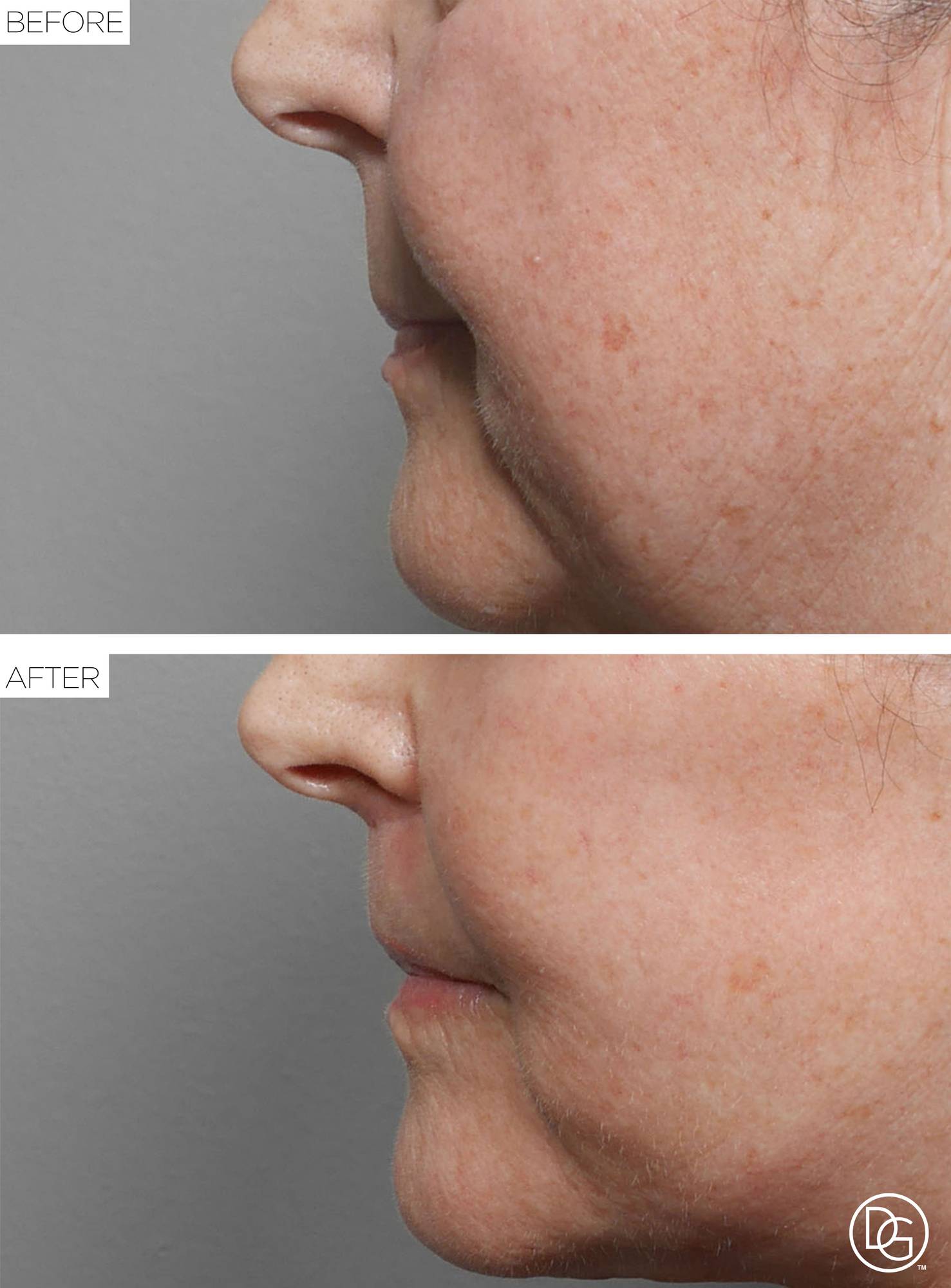 Before & After Image