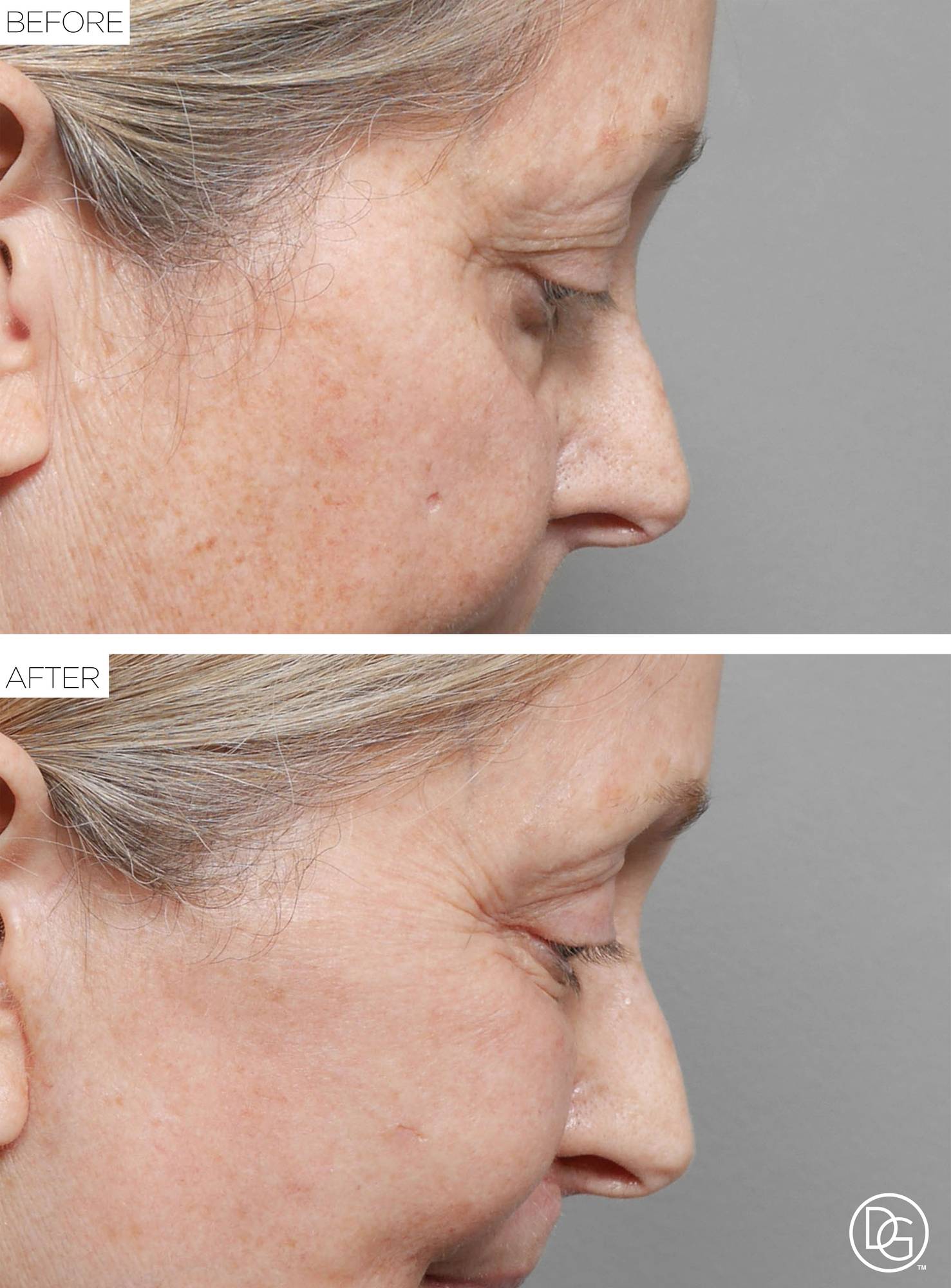 Before & After Image