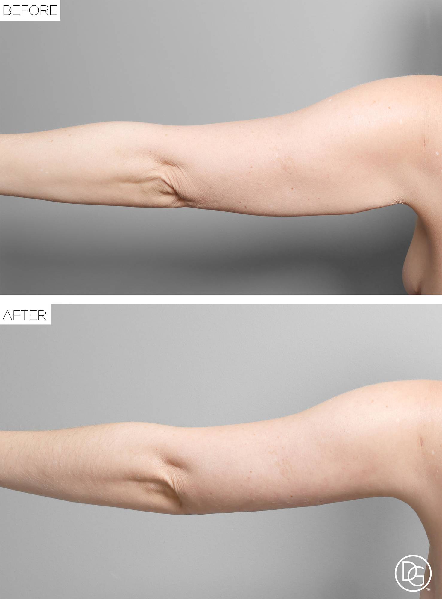 Before & After Image