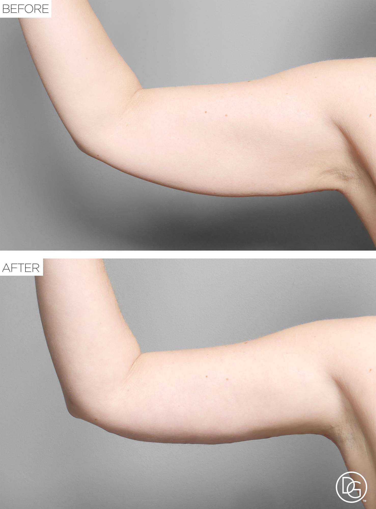 Before & After Image