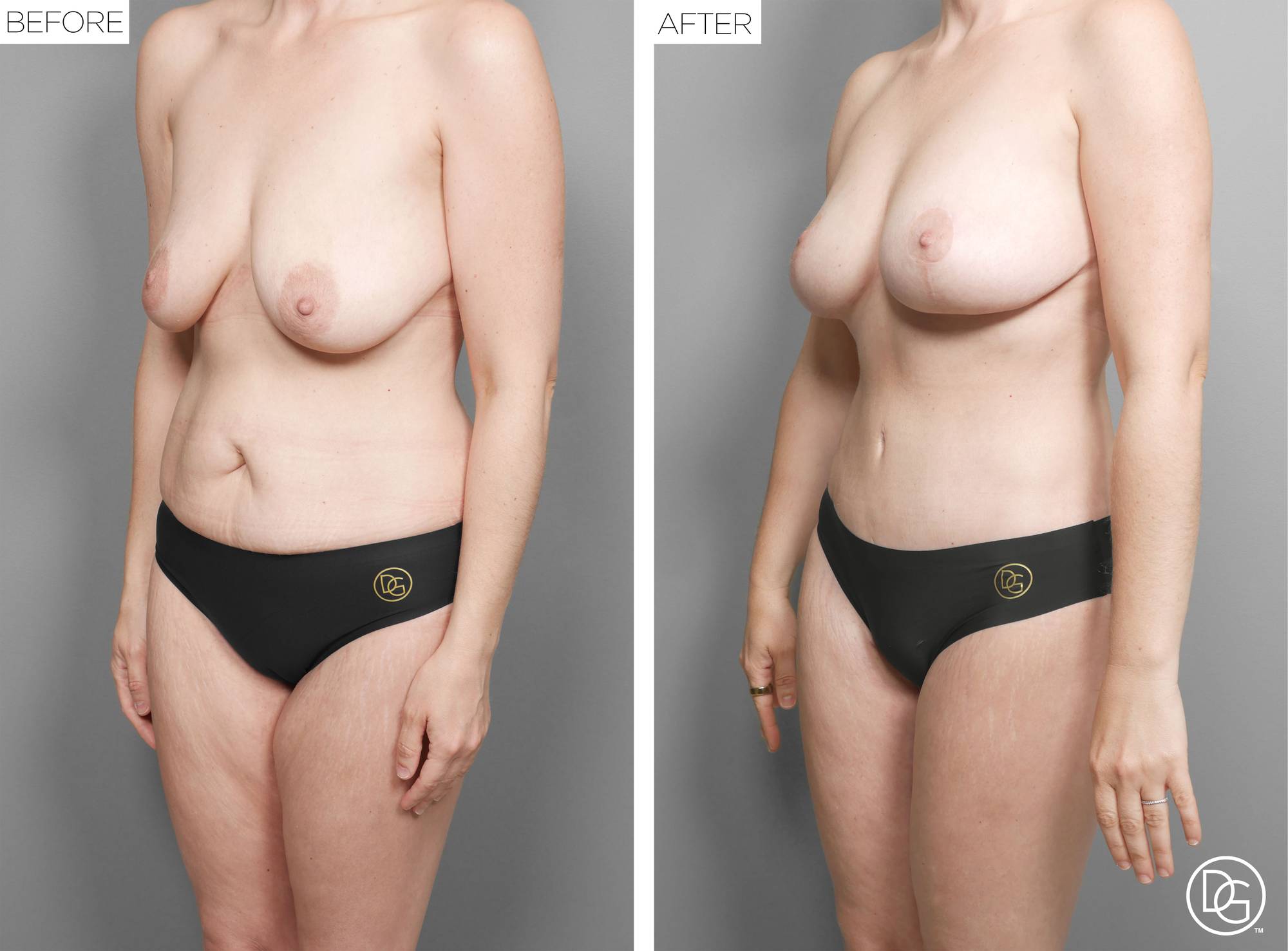 Before & After Image