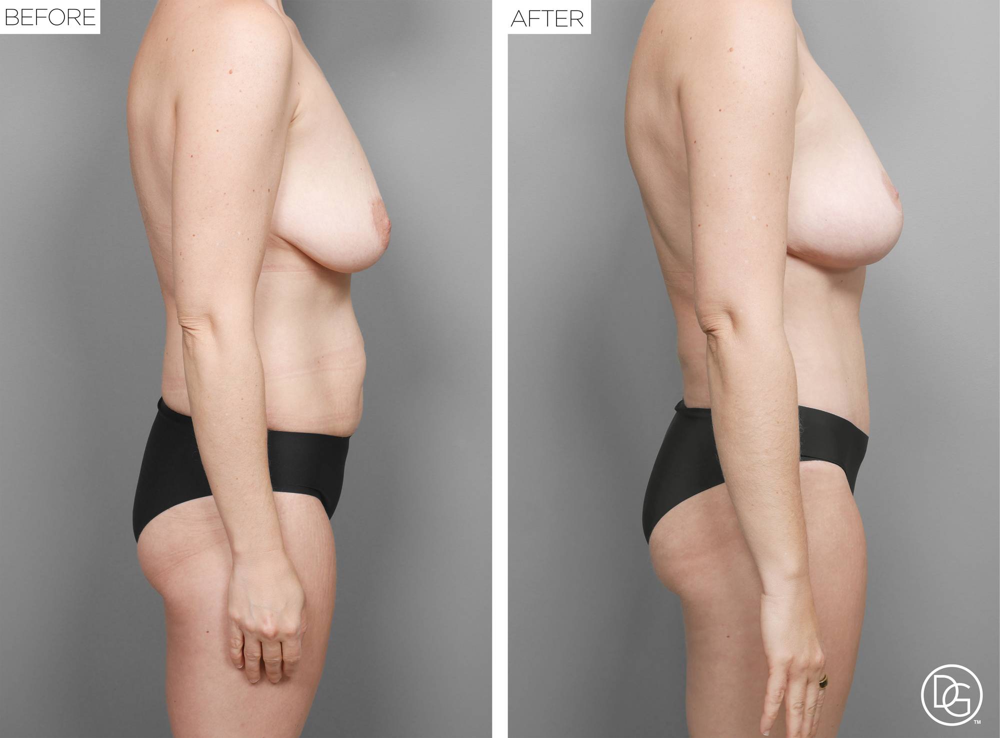 Before & After Image