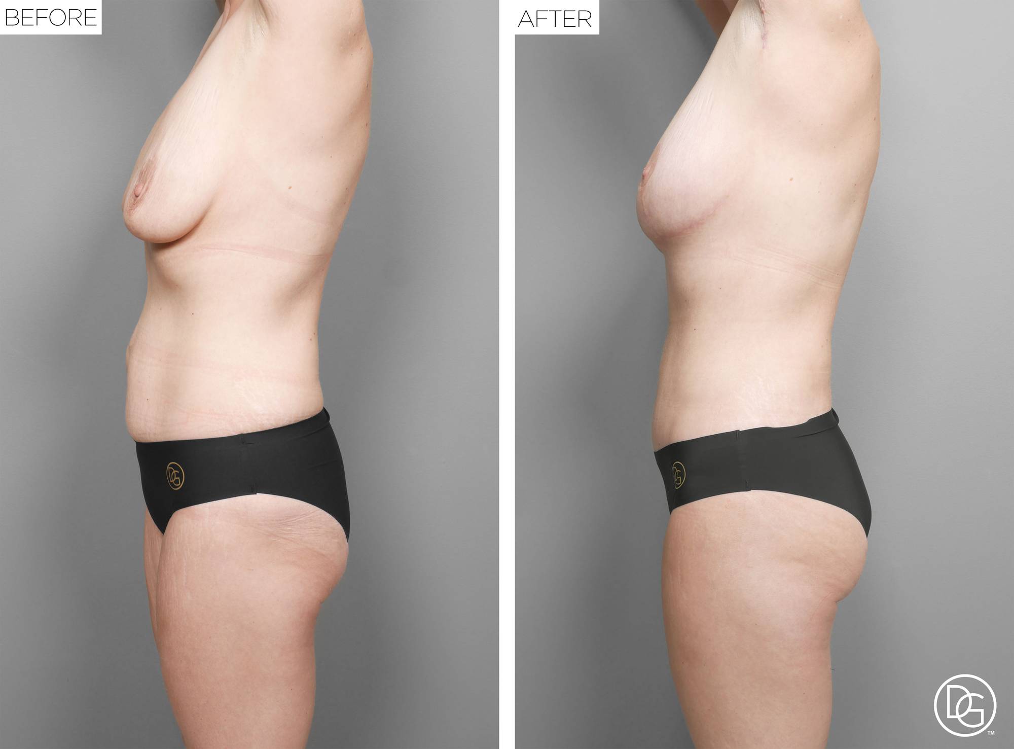 Before & After Image