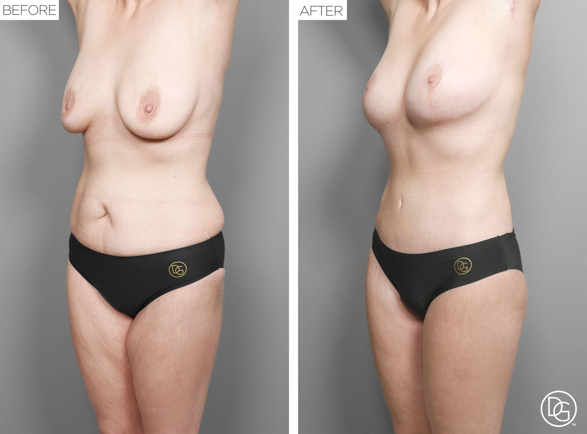 Before & After Image