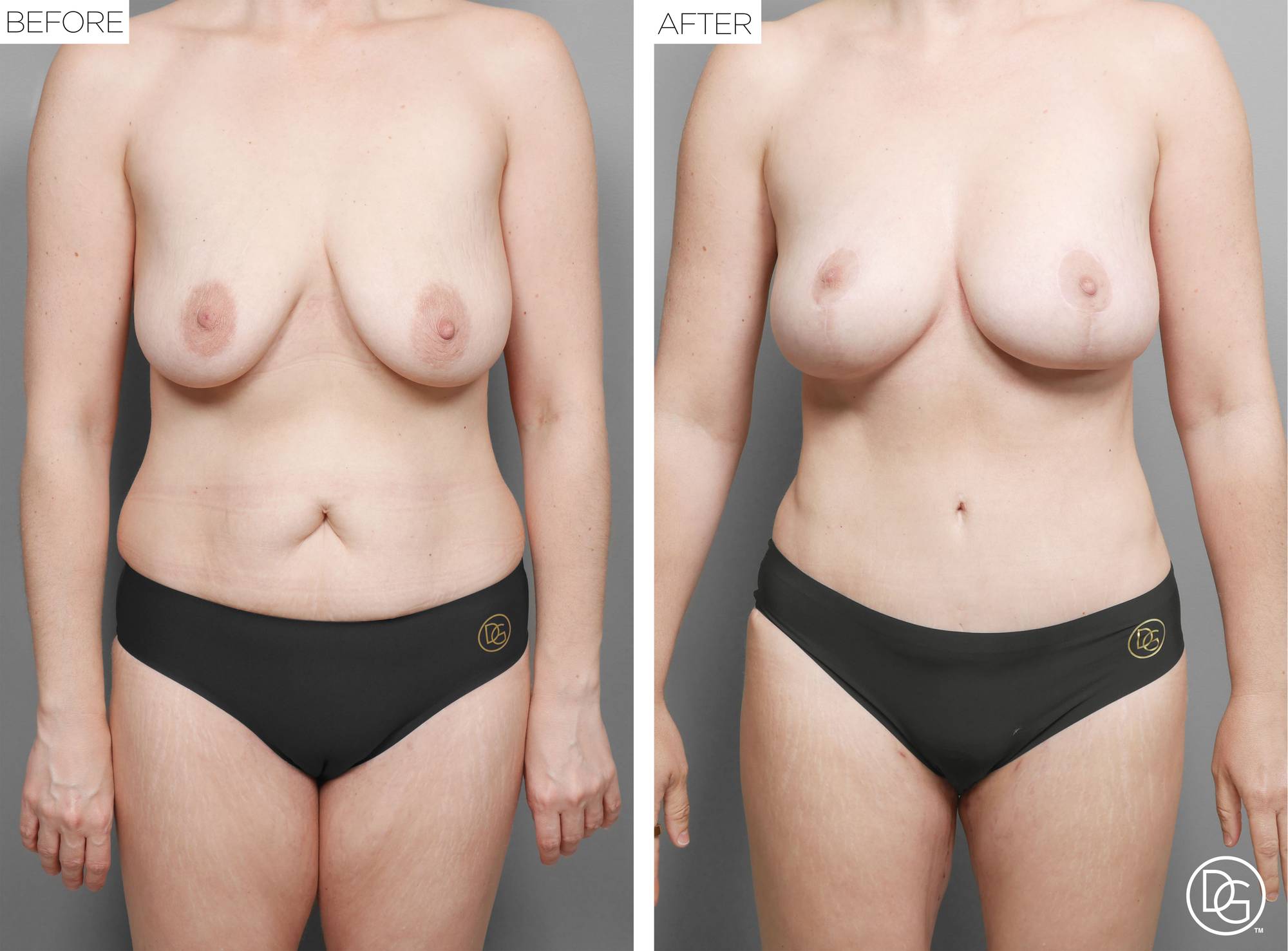 Before & After Image