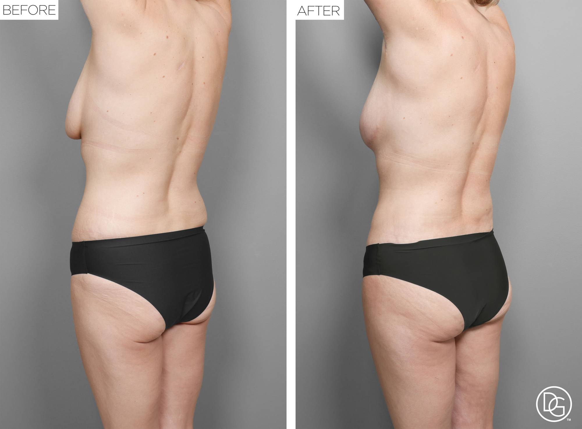 Before & After Image