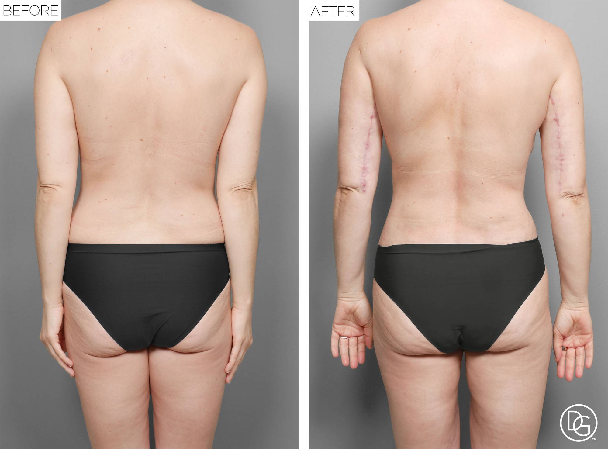 Before & After Image