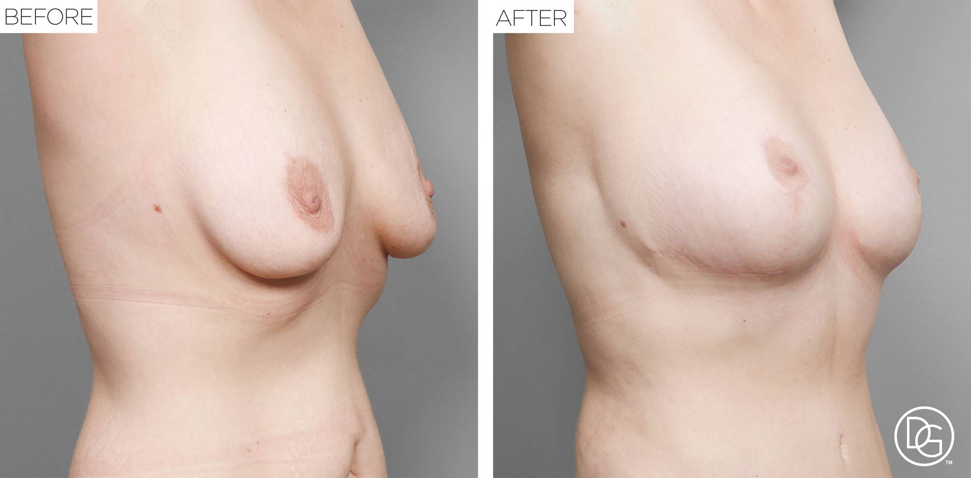 Before & After Image