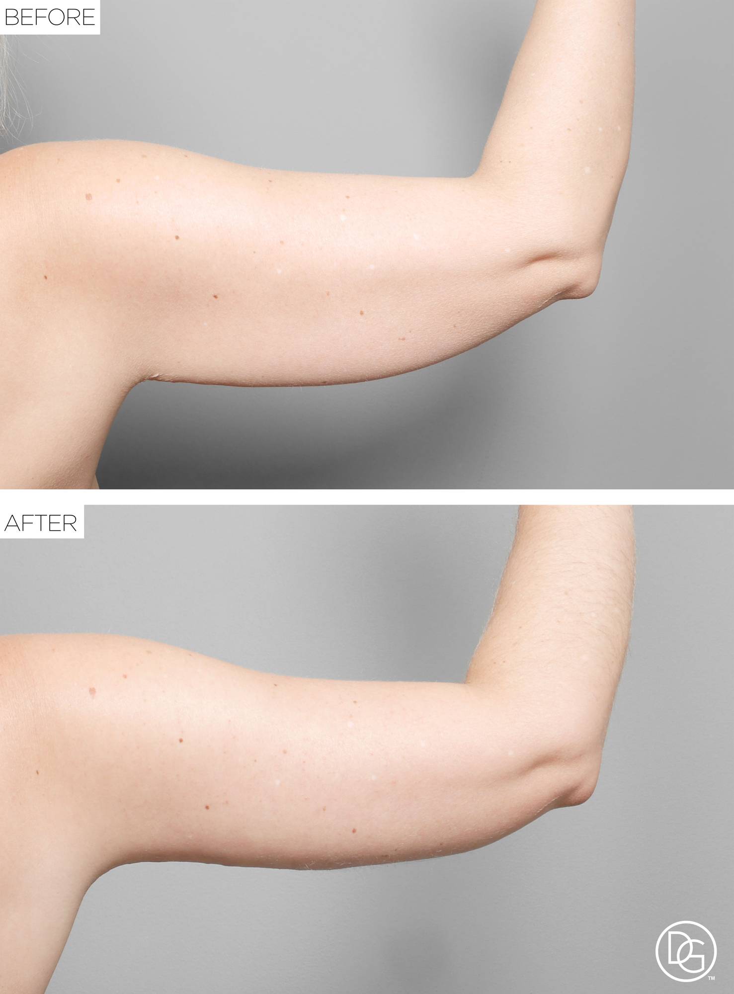 Before & After Image
