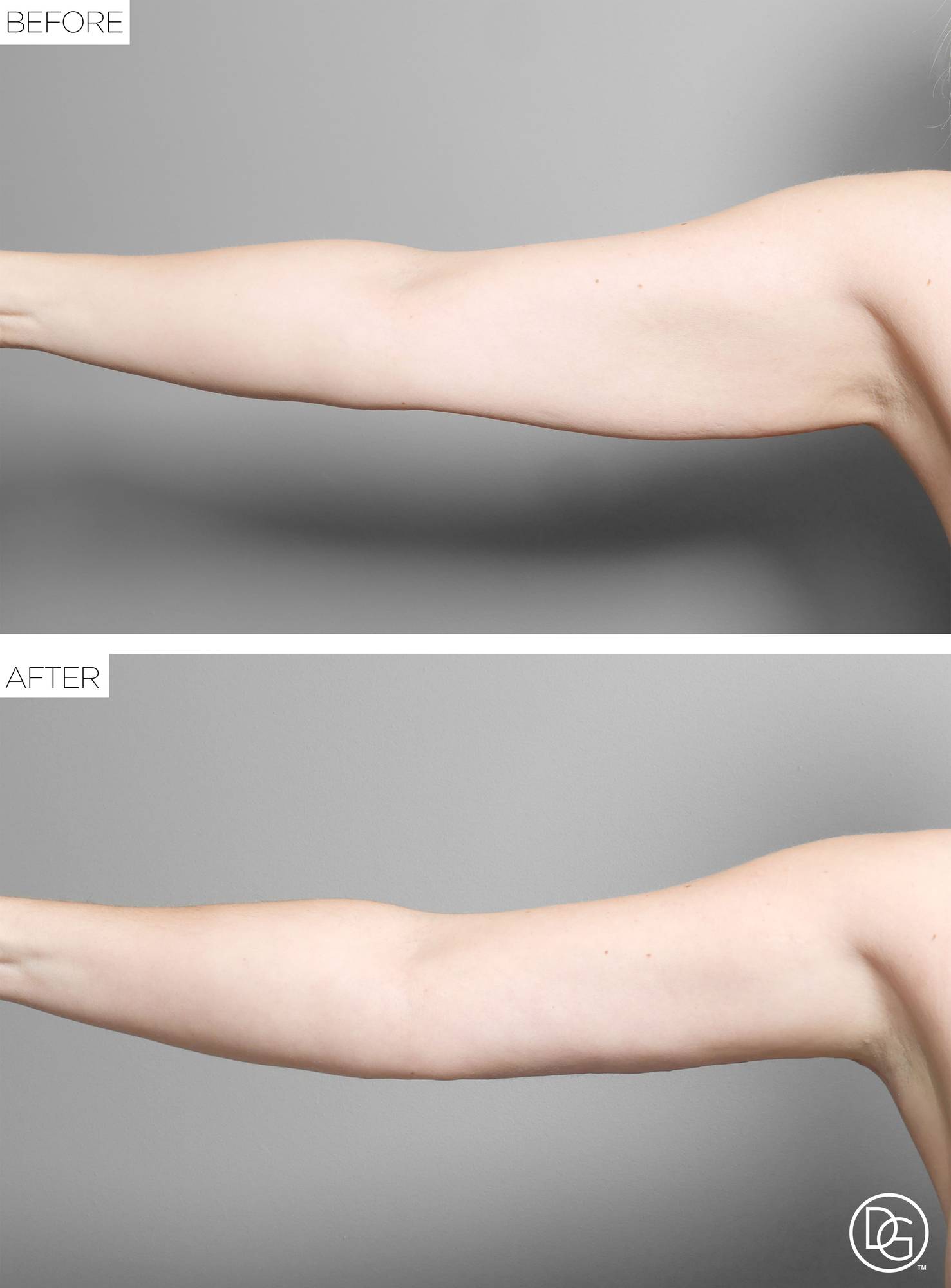 Before & After Image