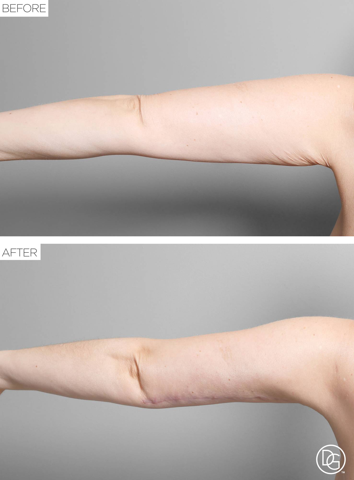 Before & After Image