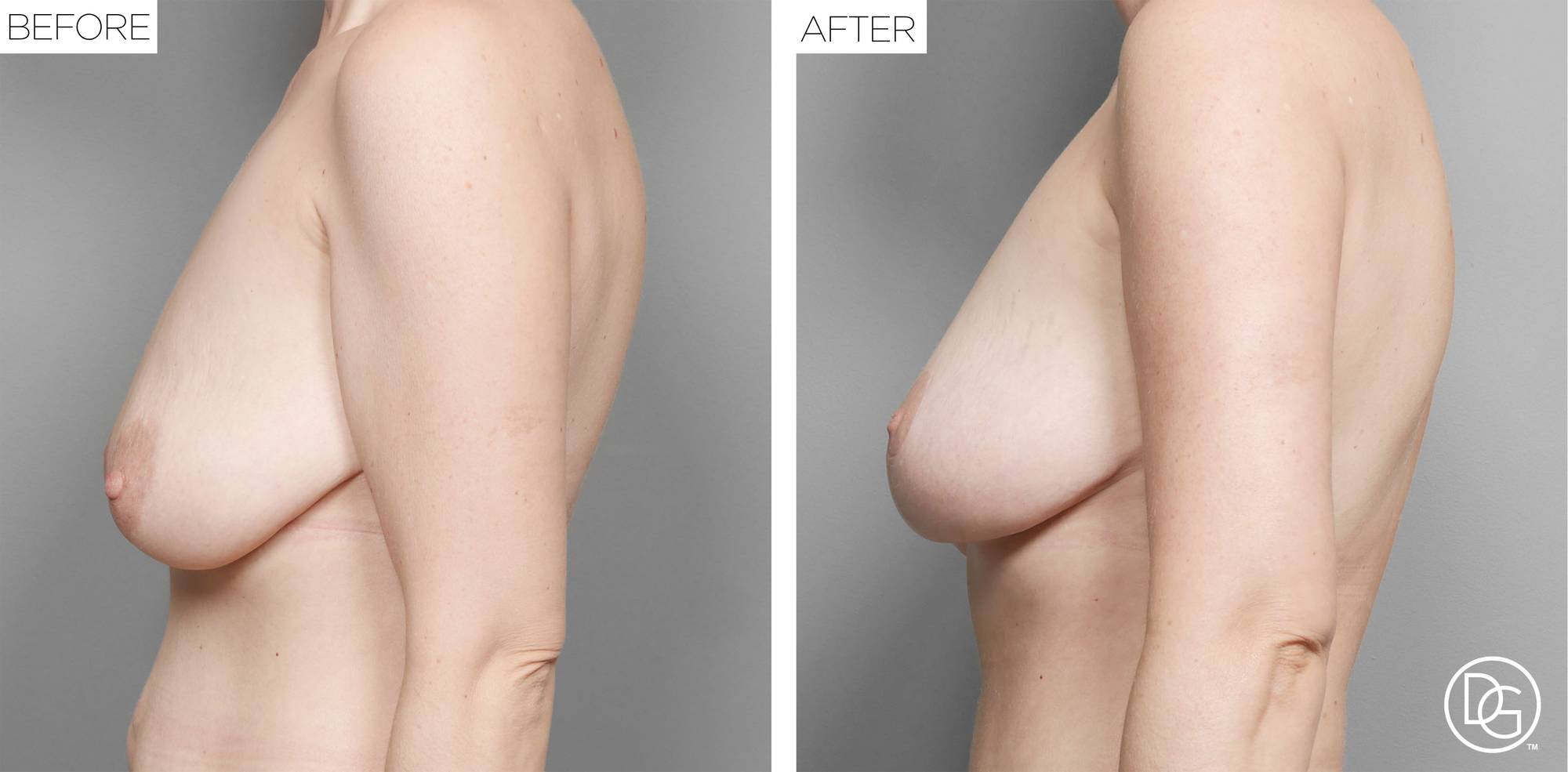 Before & After Image
