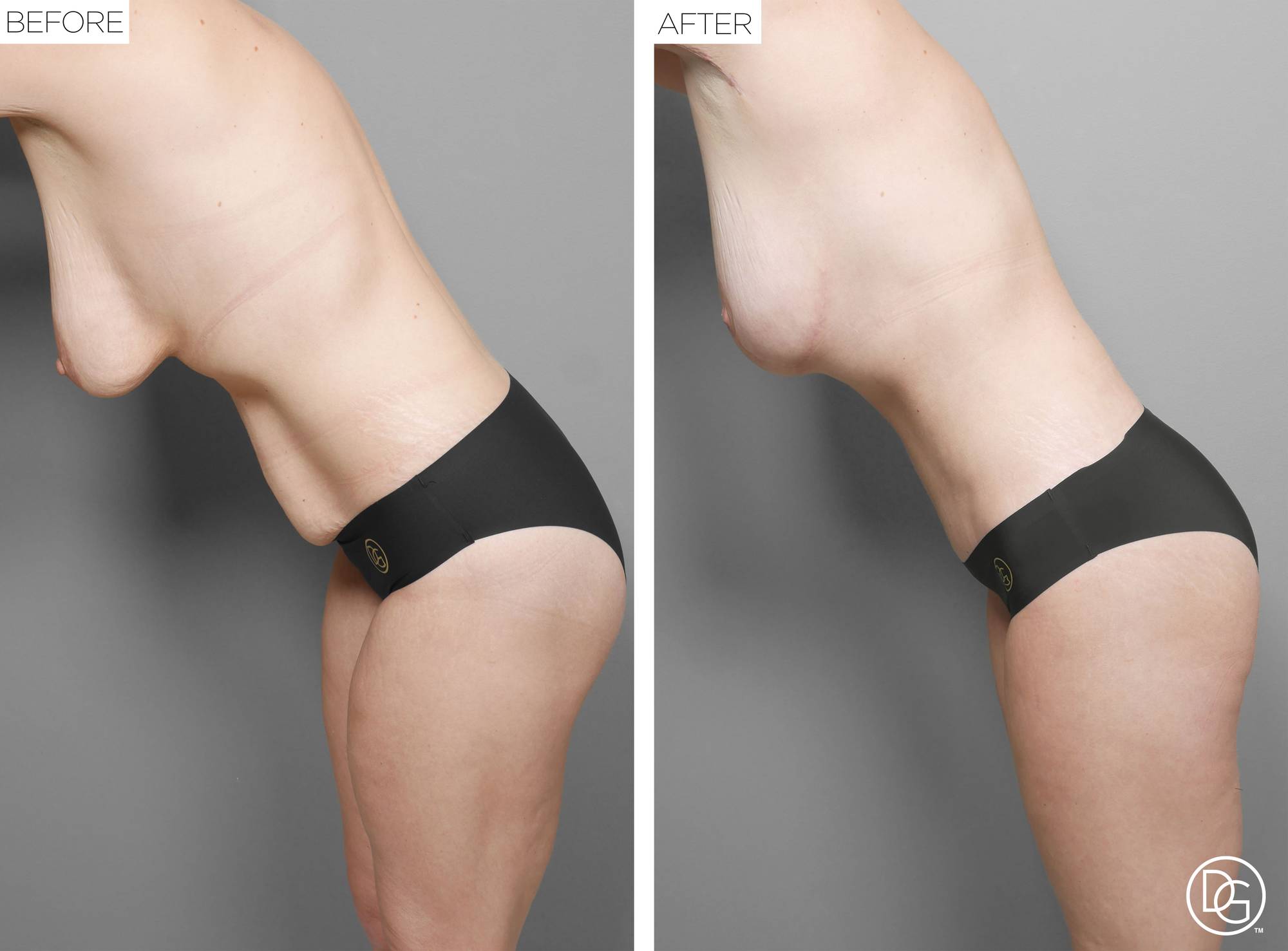 Before & After Image