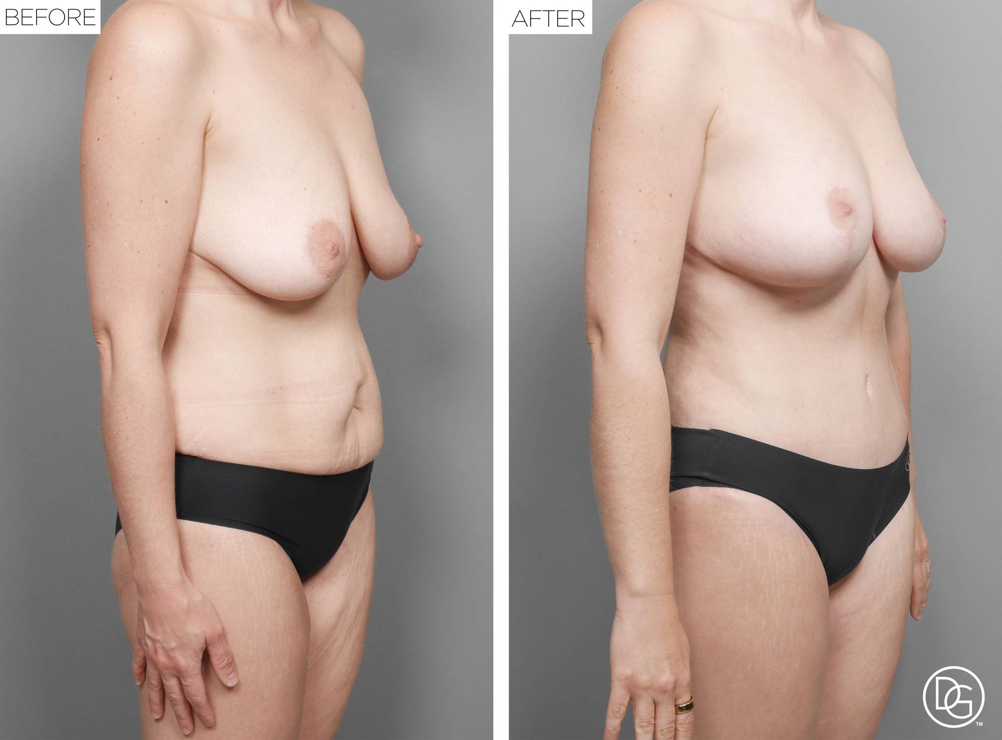 Before & After Image