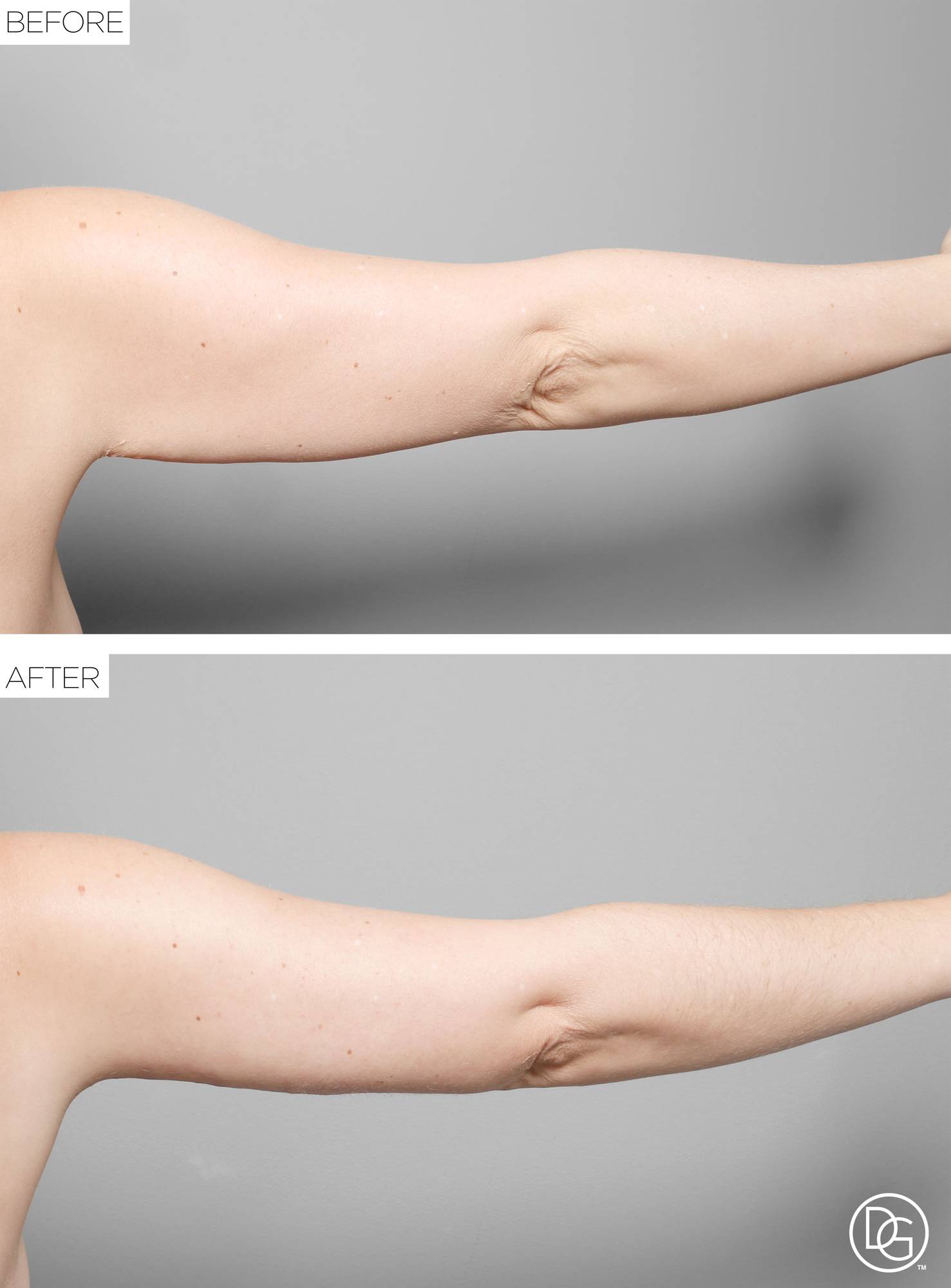 Before & After Image