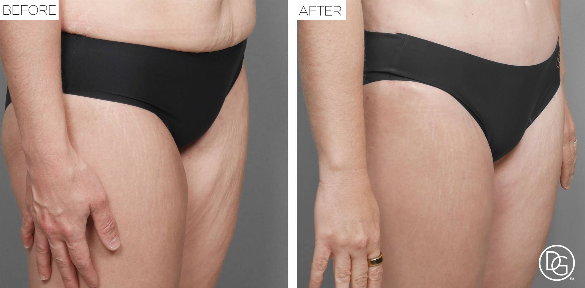 Before & After Image