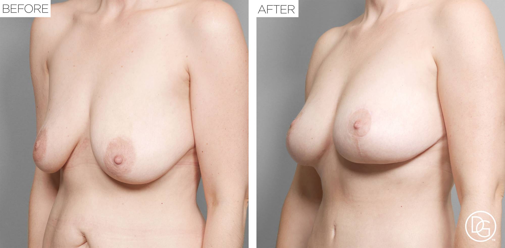 Before & After Image